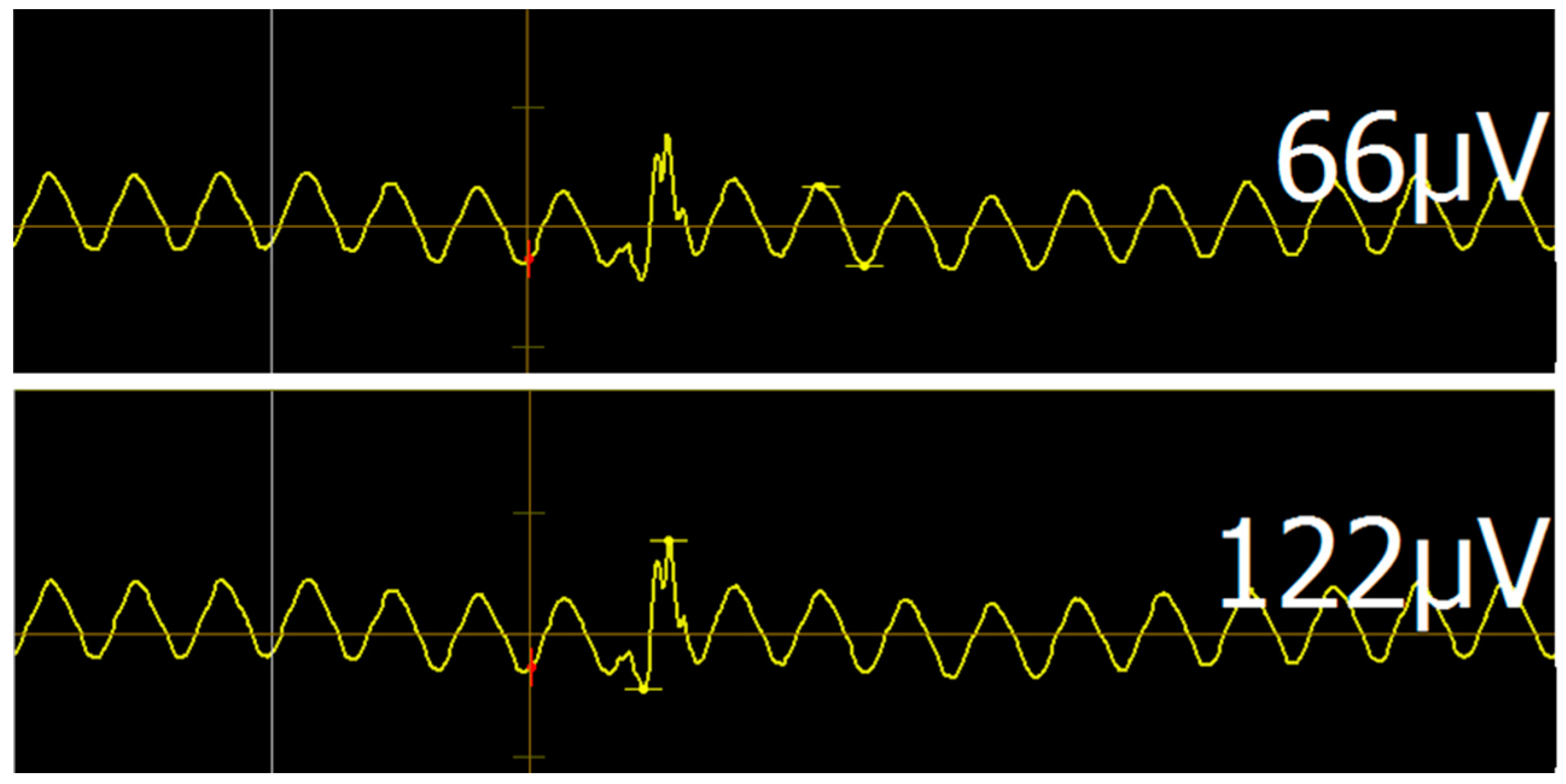Brainsci 10 01005 g005