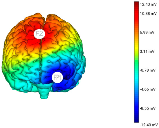 Brainsci 10 01008 g001 550