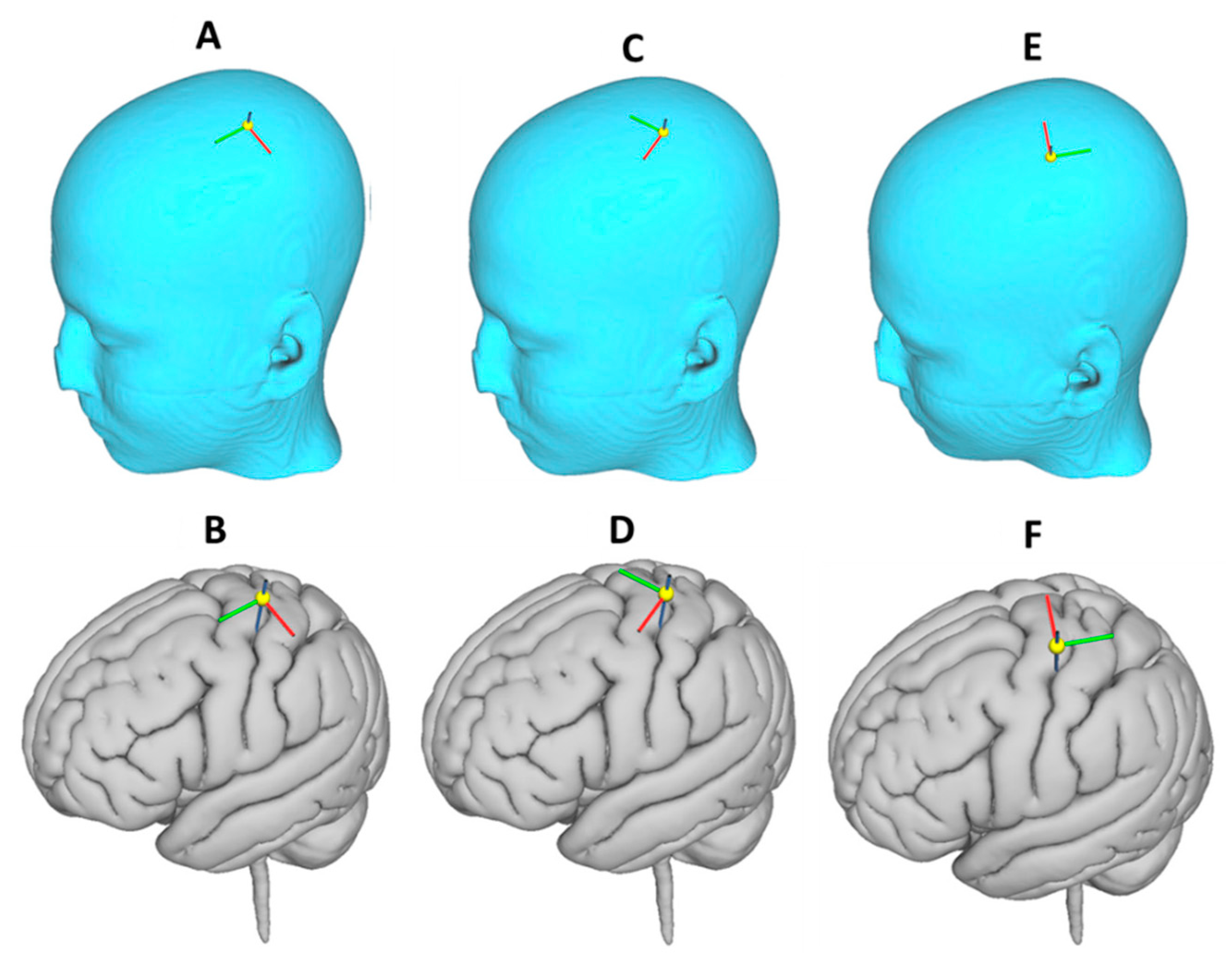 Brainsci 10 01010 g003 Brainsci 10 01010 g003