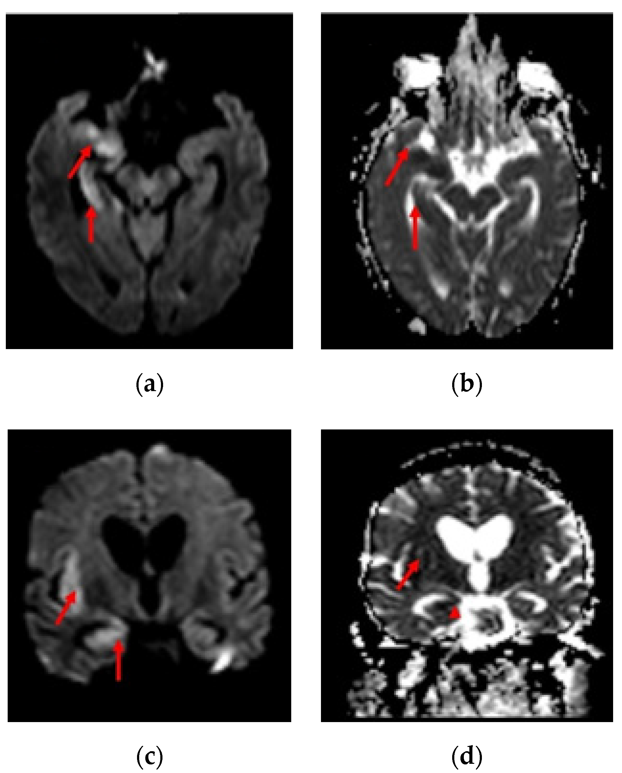Brainsci 10 01017 g003
