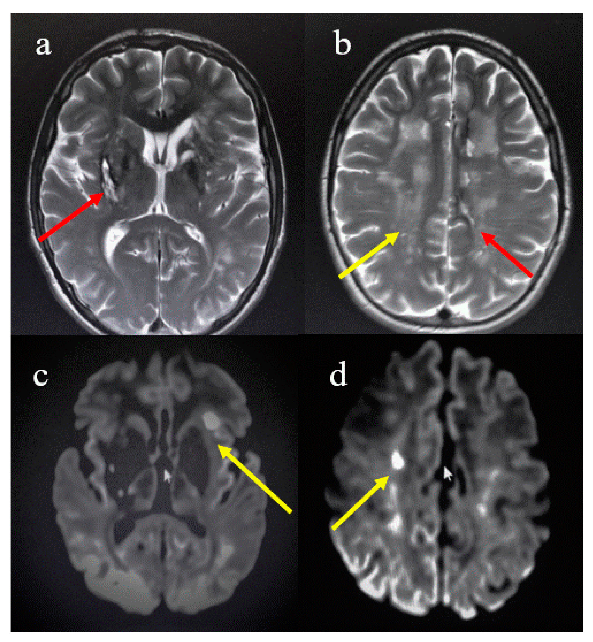 Brainsci 11 00021 g001 Brainsci 11 00021 g001