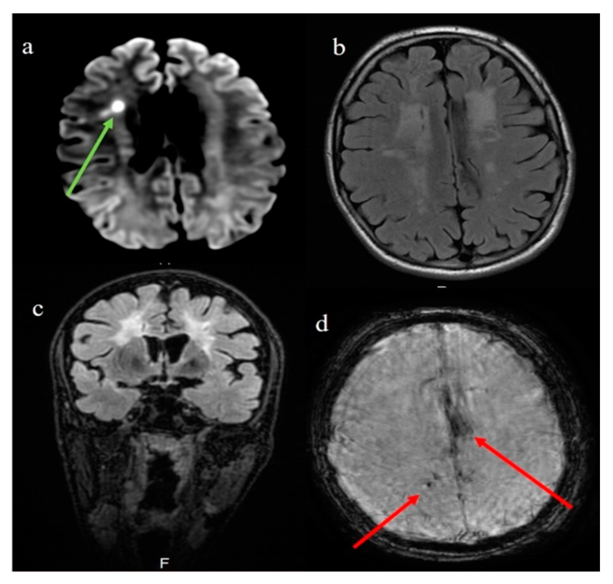 Brainsci 11 00021 g002 Brainsci 11 00021 g002