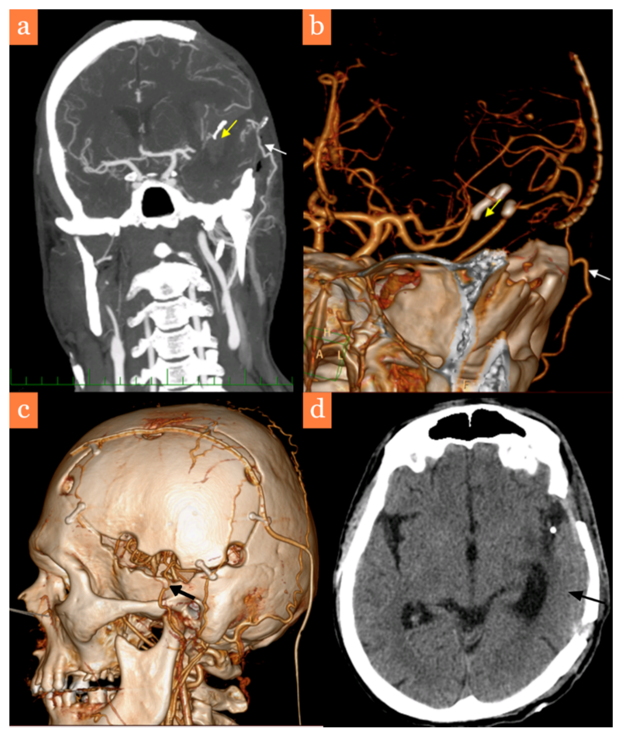 Brainsci 11 00029 g003