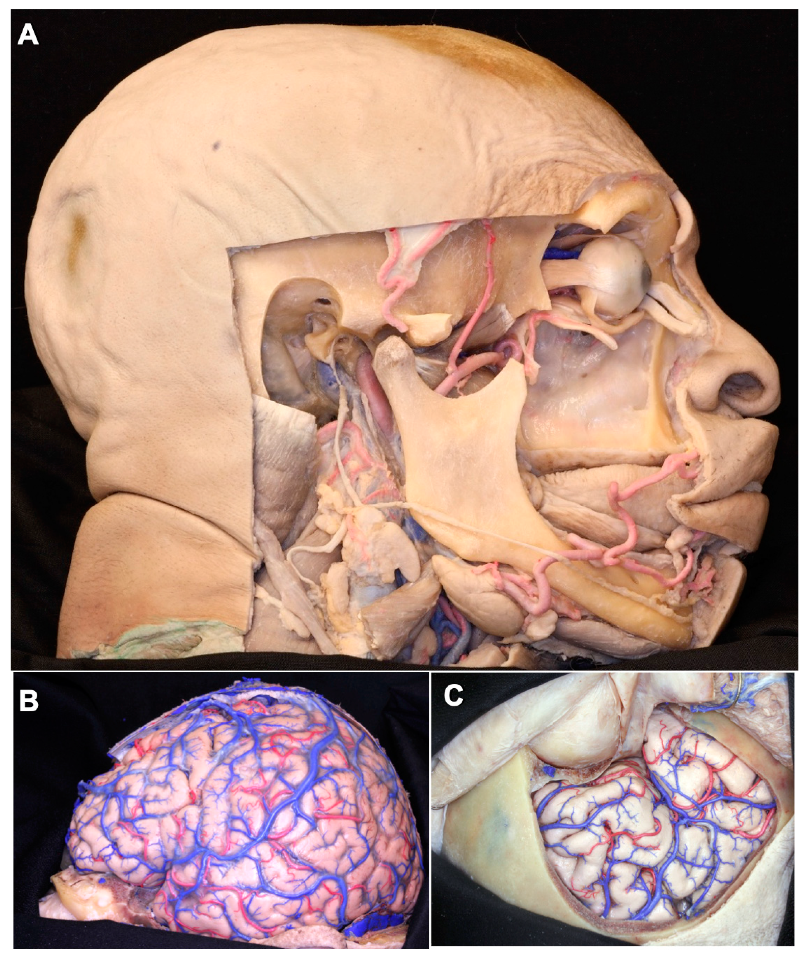 Brainsci 11 00032 g002a Brainsci 11 00032 g002a