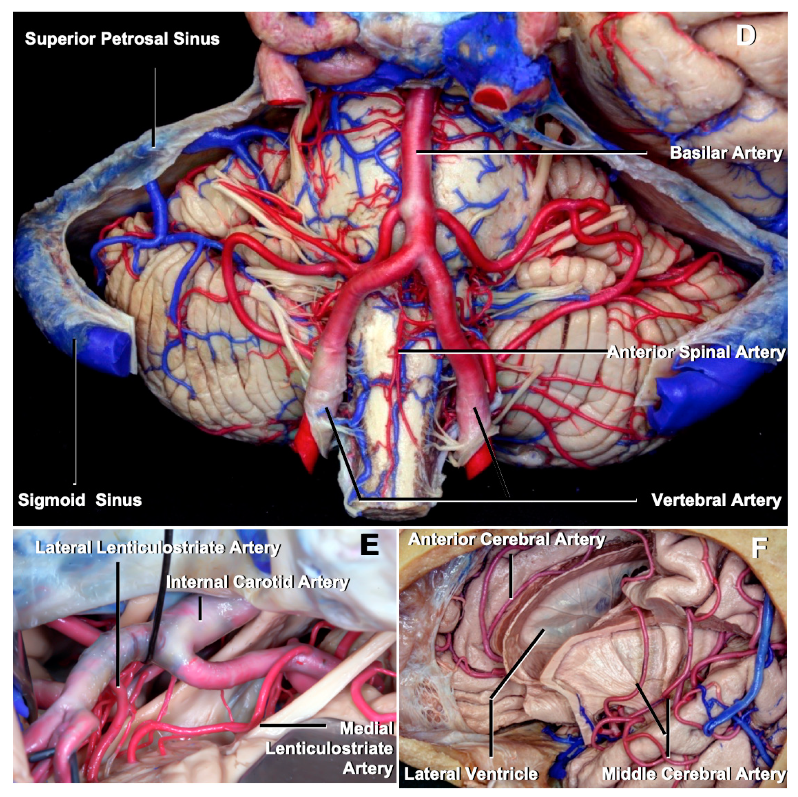 Brainsci 11 00032 g002b Brainsci 11 00032 g002b