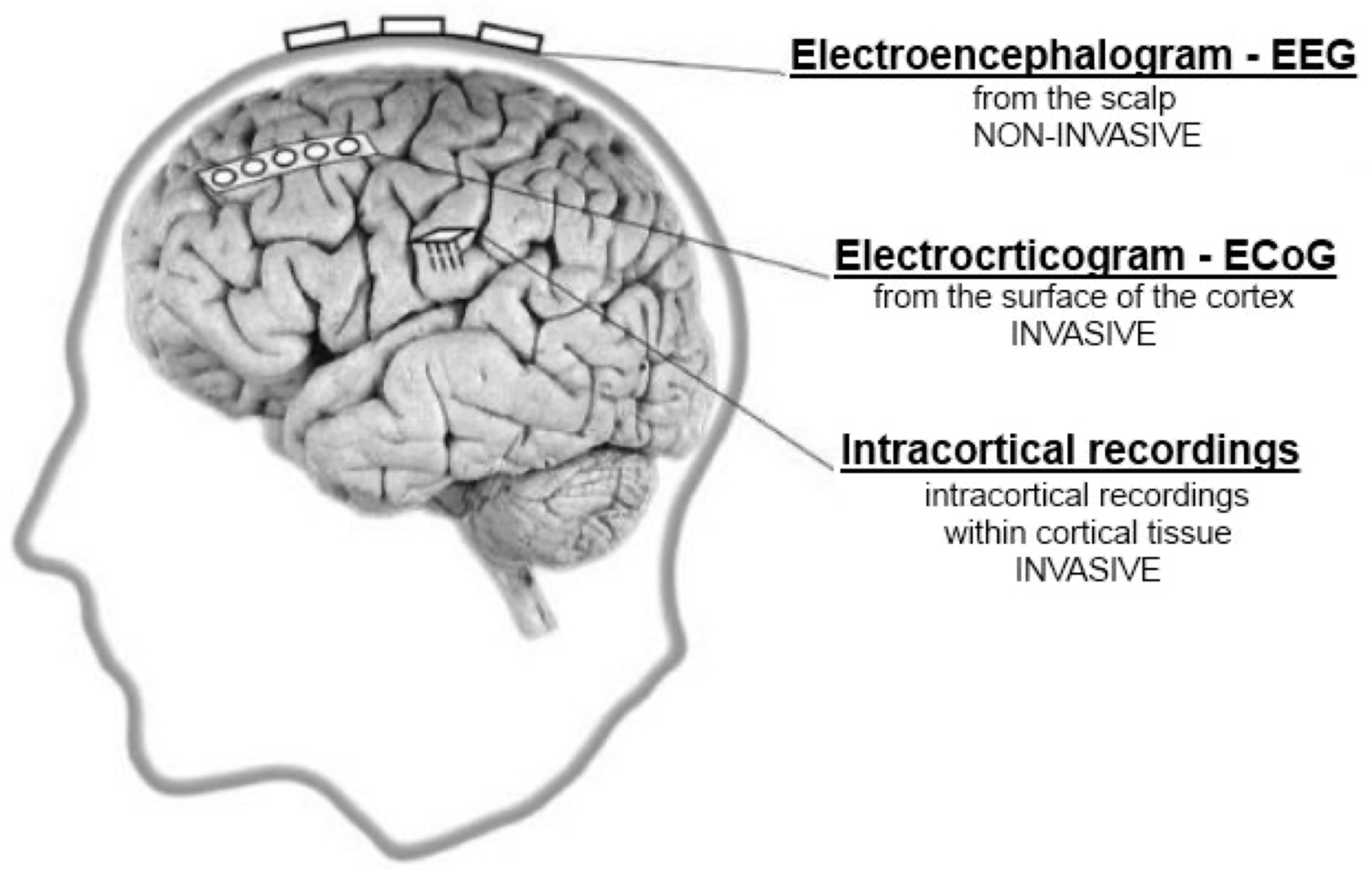 Brainsci 11 00043 g002