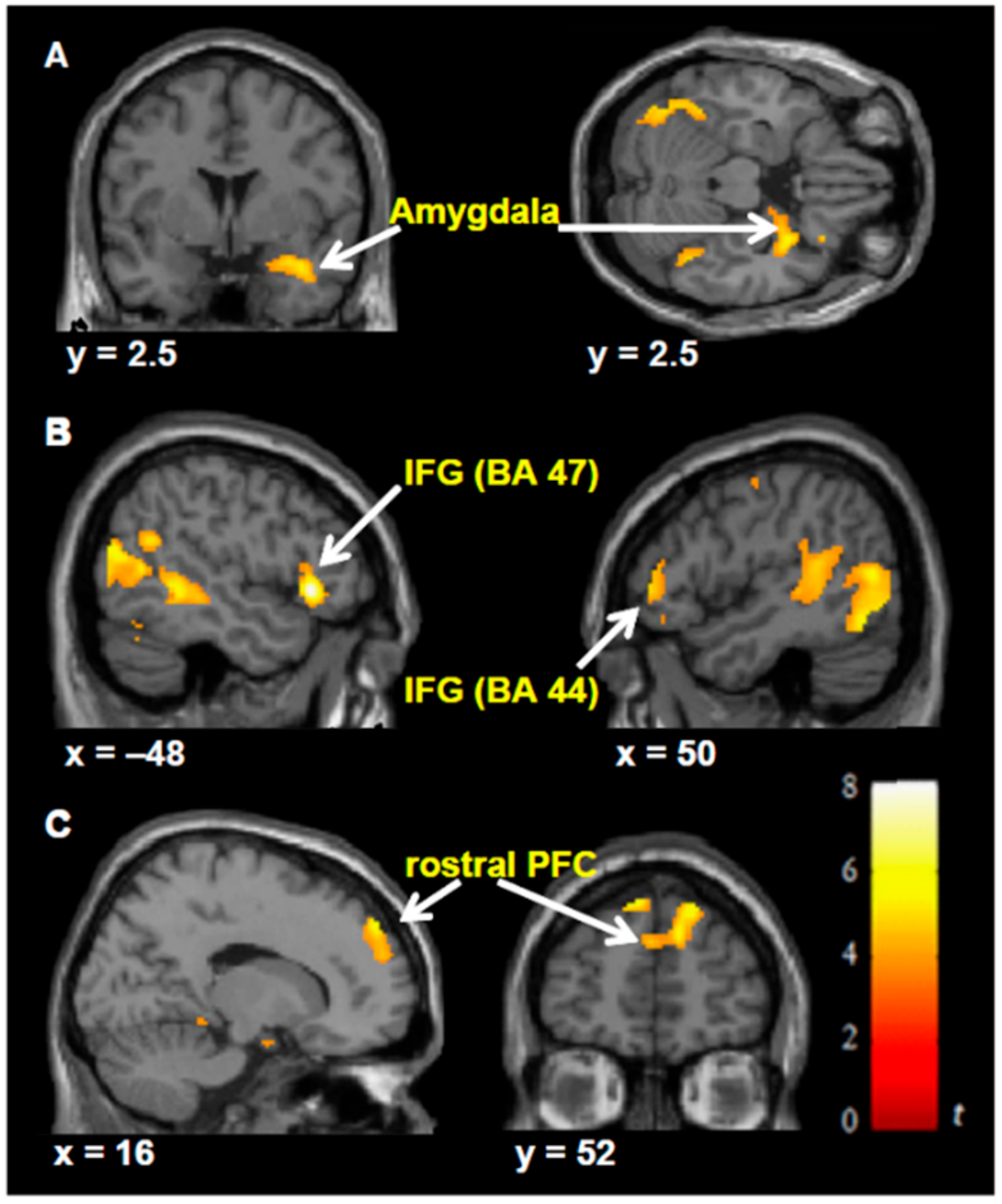 Brainsci 11 00051 g005