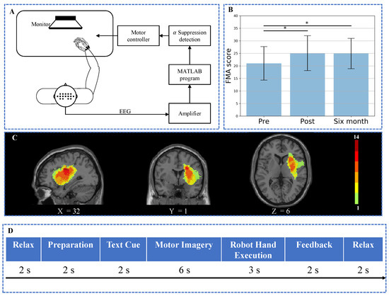 BCI Training Effects on Chronic Stroke Correlate with