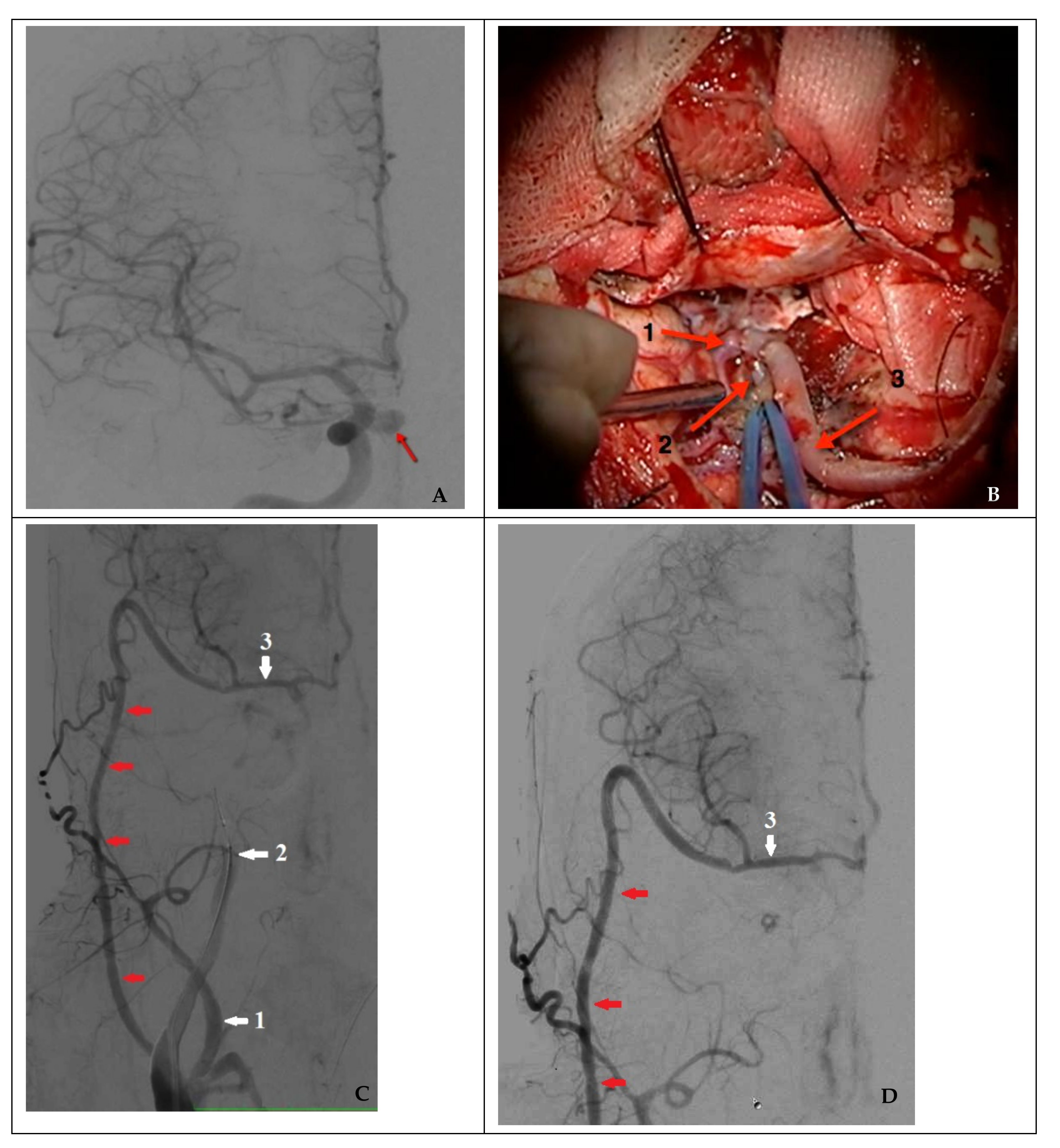 Brainsci 11 00099 g005 Brainsci 11 00099 g005