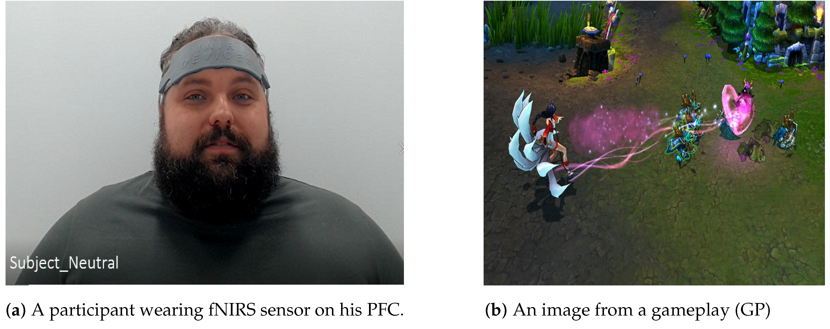 Brainsci 11 00106 g003 Brainsci 11 00106 g003