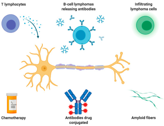 Brain biopsy: The smear technique for neurosurgical biopsies