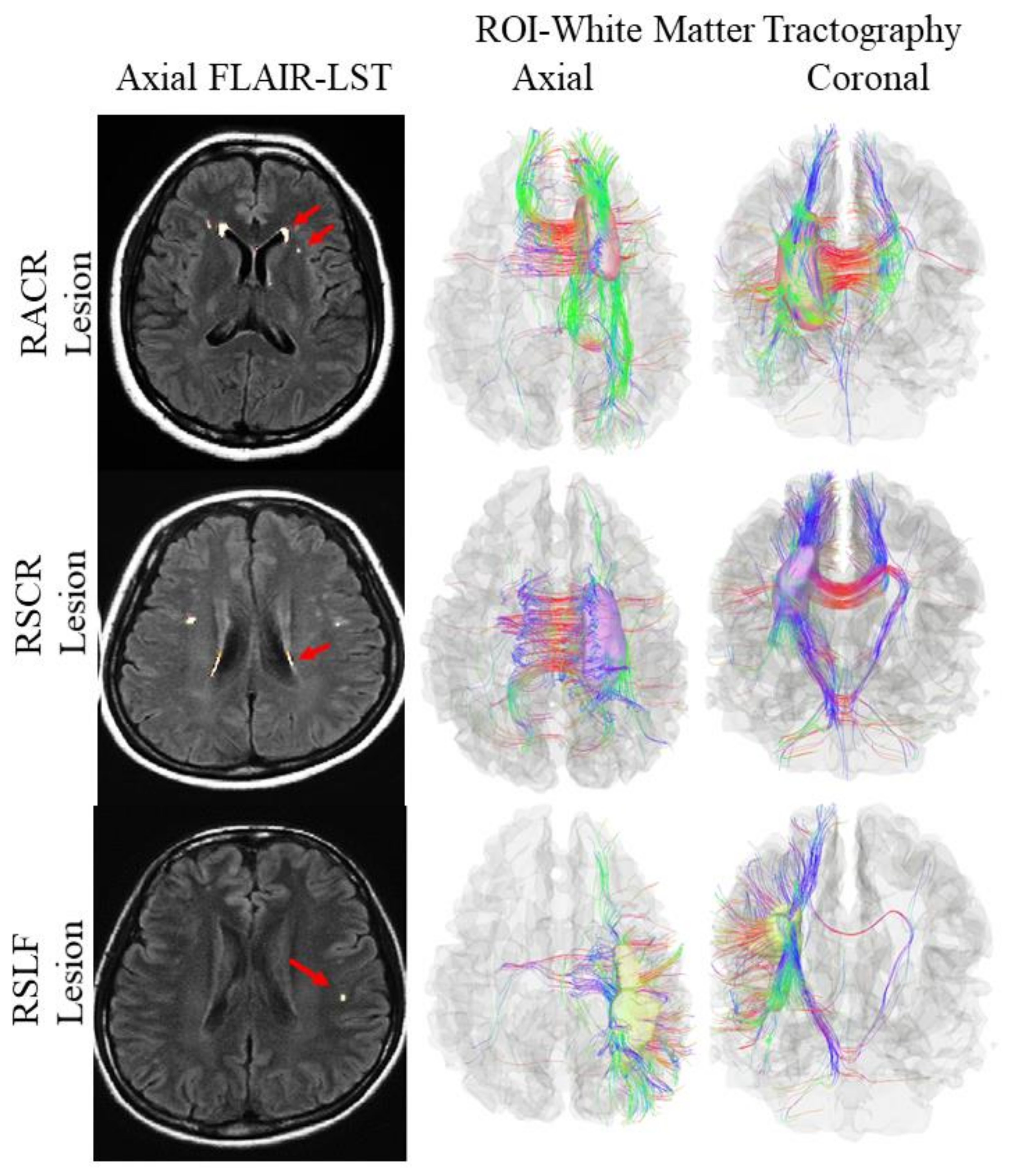 Brainsci 11 00133 g001 Brainsci 11 00133 g001