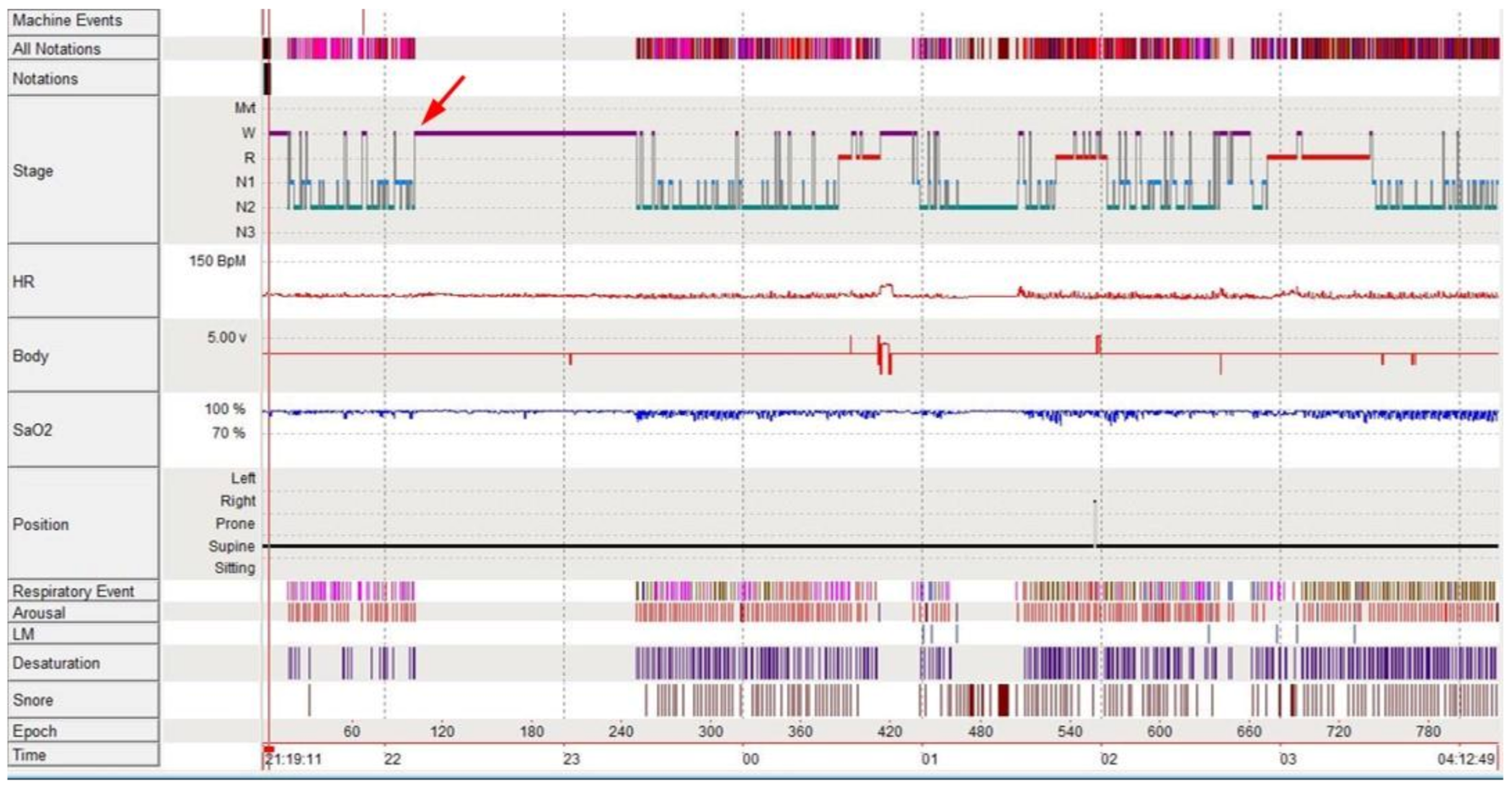 Brainsci 11 00137 g001