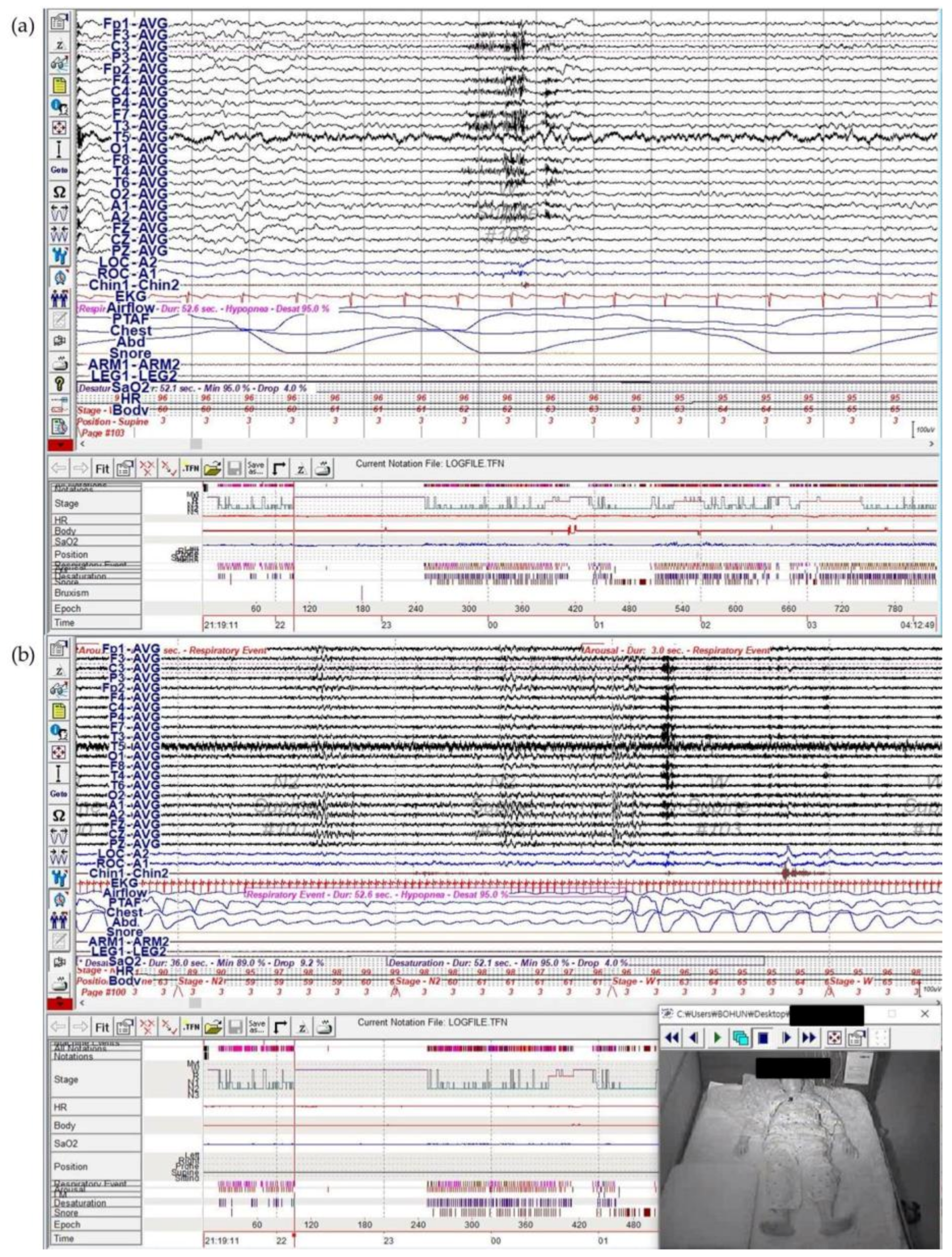 Brainsci 11 00137 g002