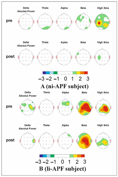 Brainsci 11 00167 g007 Brainsci 11 00167 g007