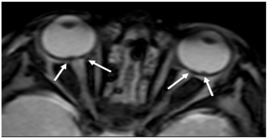 Brainsci 11 00179 g001 550