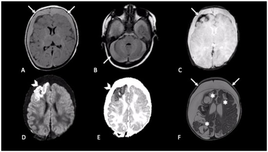 Brainsci 11 00179 g002 550