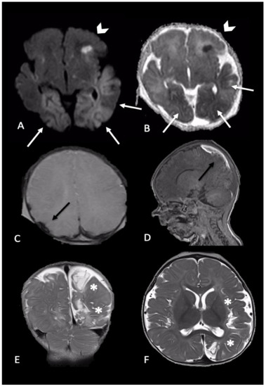 Brainsci 11 00179 g003 550