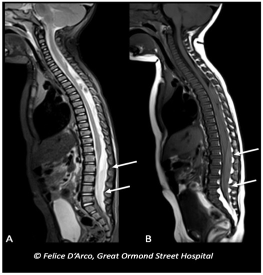 Brainsci 11 00179 g005 550