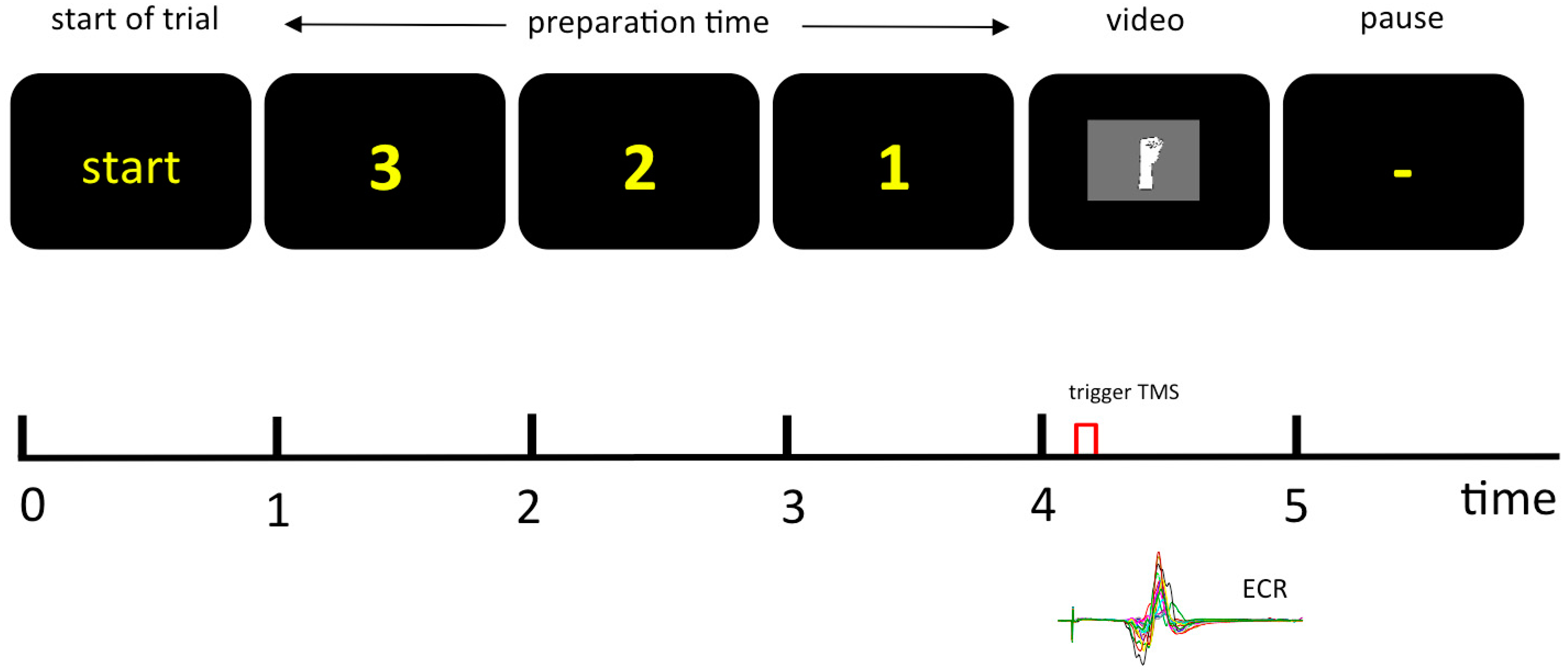 Brainsci 11 00187 g001 Brainsci 11 00187 g001
