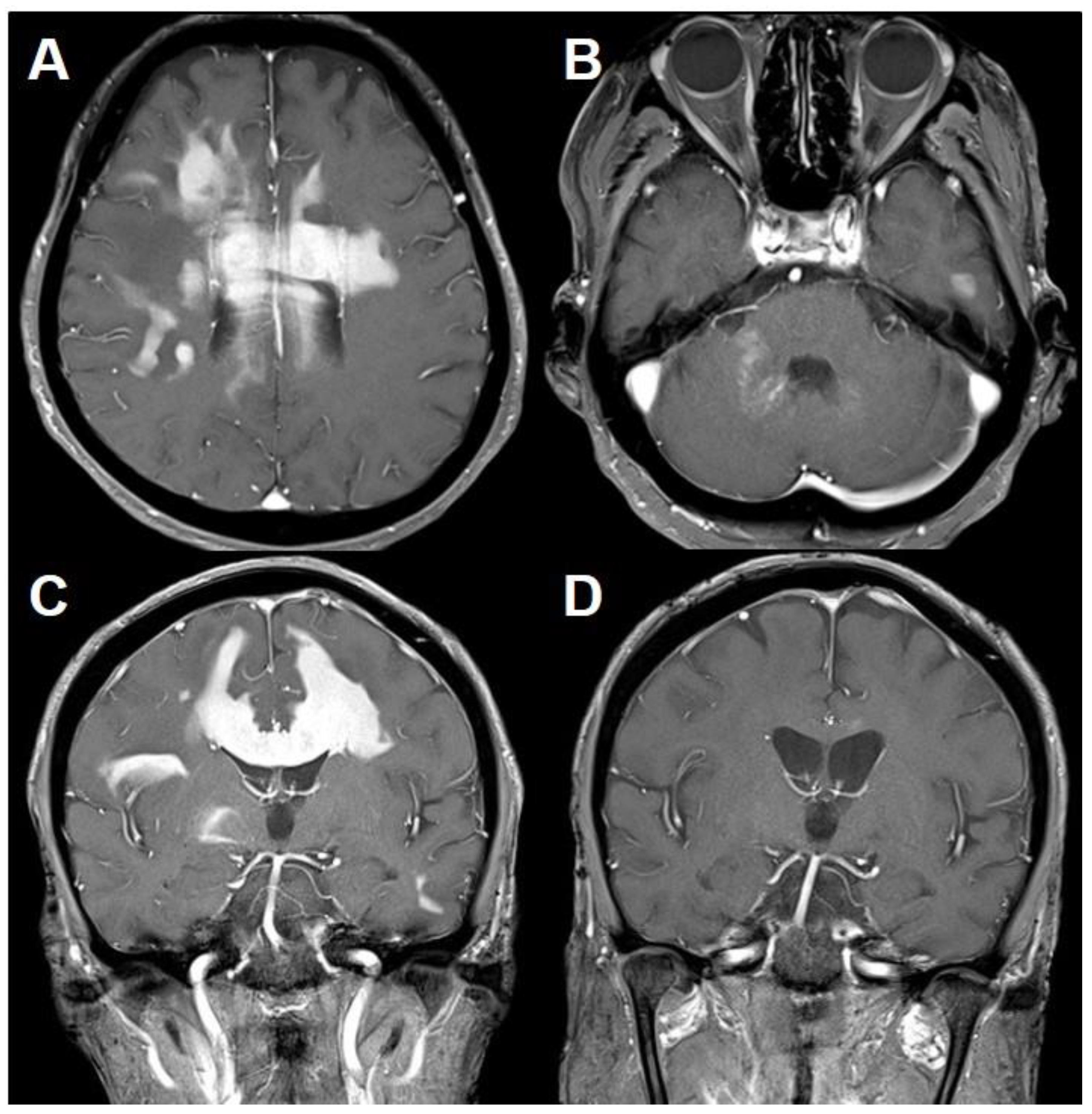 Brainsci 11 00191 g003
