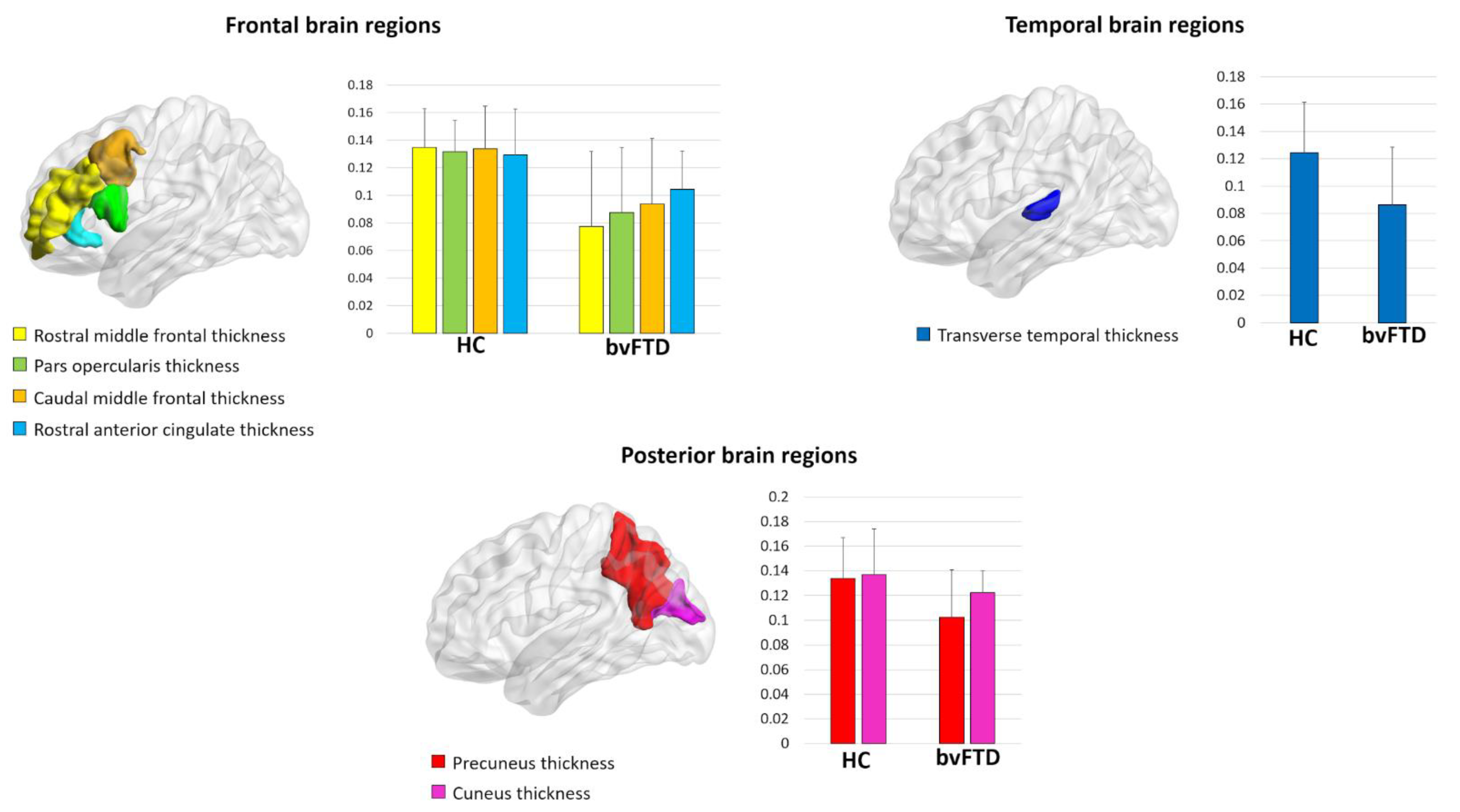 Brainsci 11 00192 g001 Brainsci 11 00192 g001