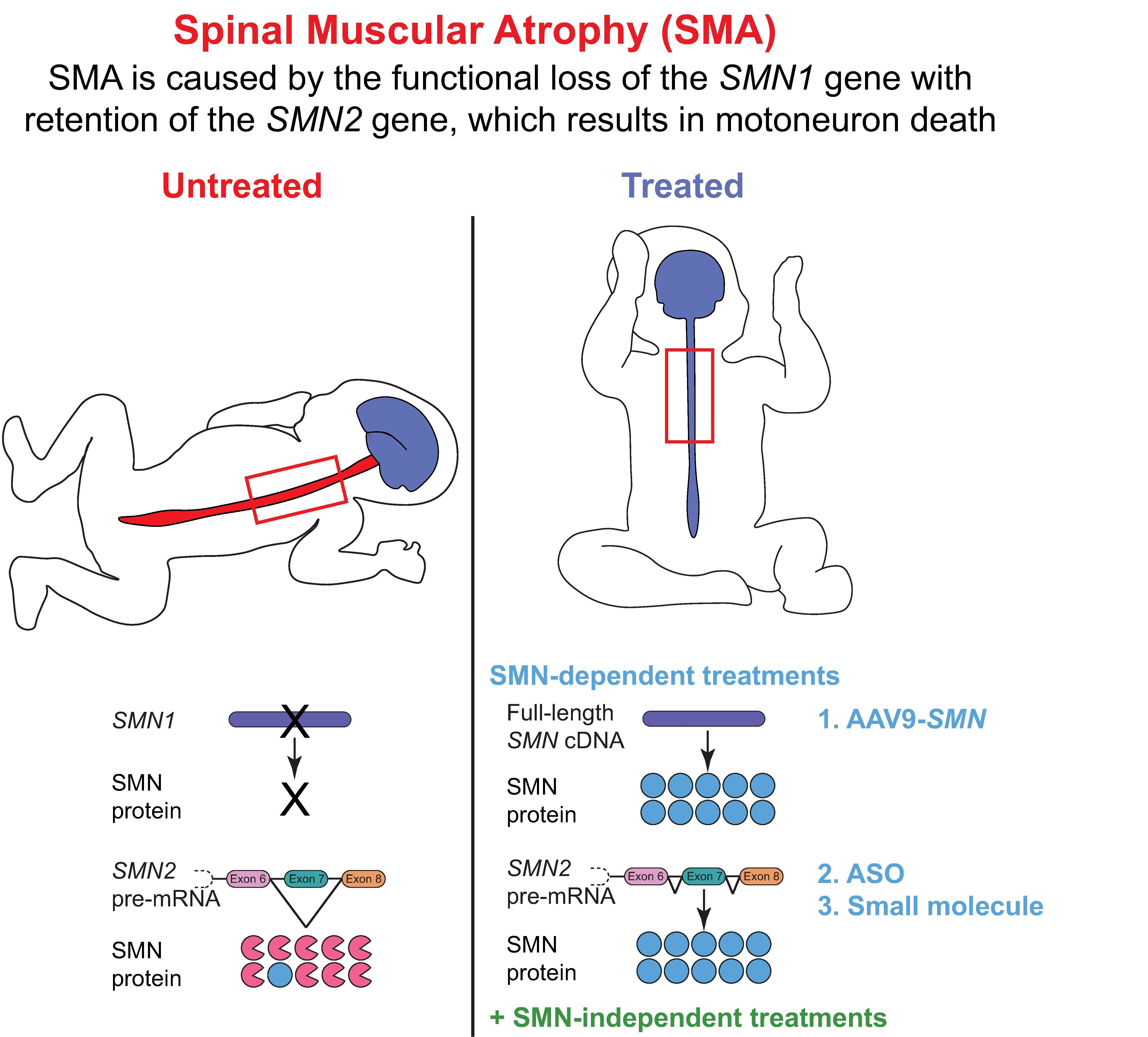 In Search of a Cure: The Development of Therapeutics to Alter the Progressi...