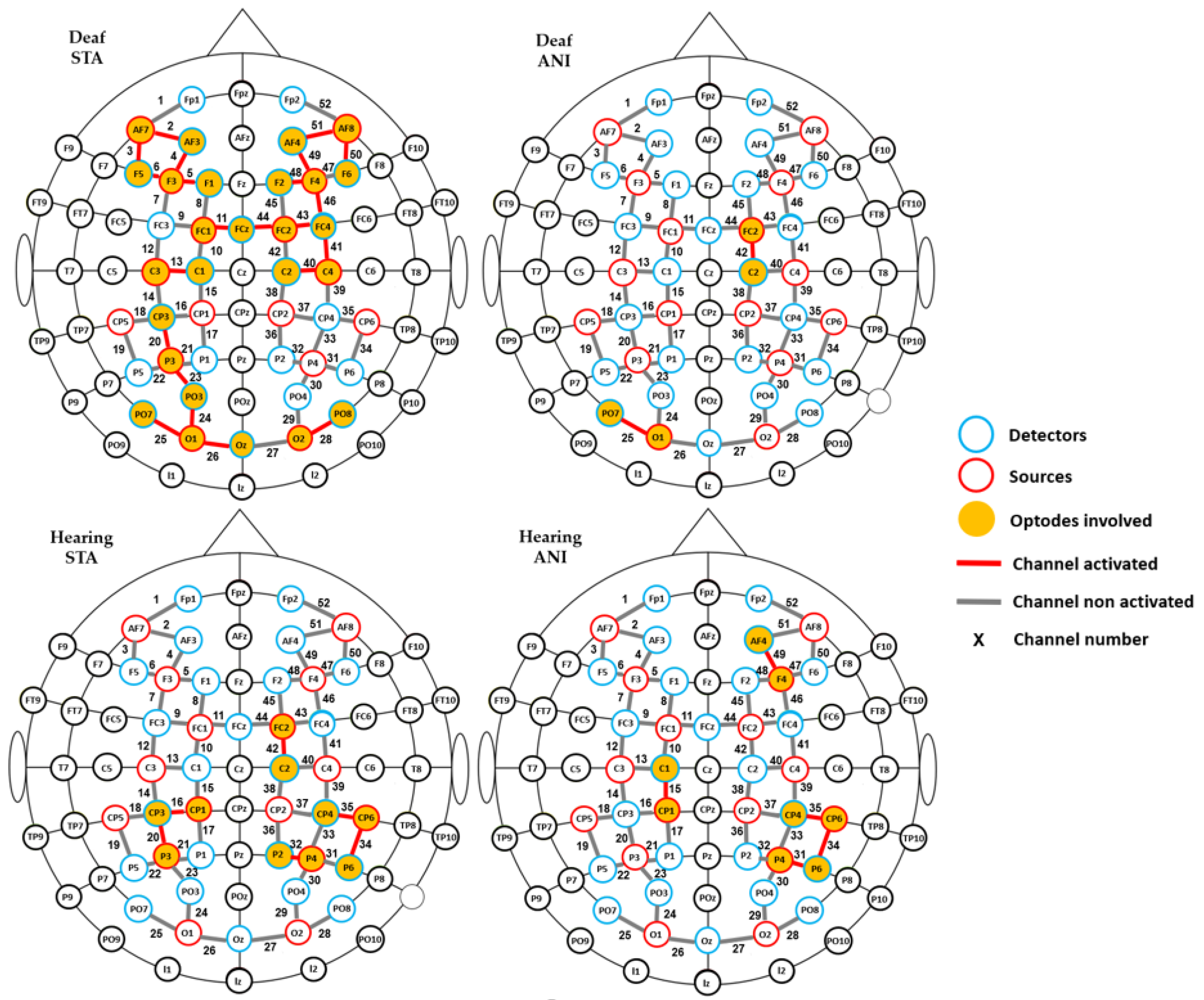 Brainsci 11 00196 g004 Brainsci 11 00196 g004
