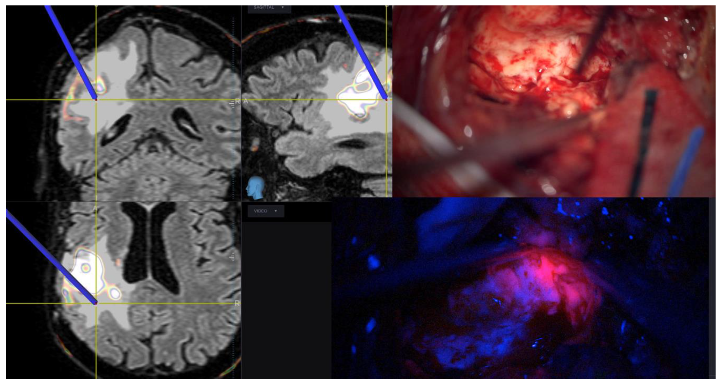 Brainsci 11 00200 g003 Brainsci 11 00200 g003