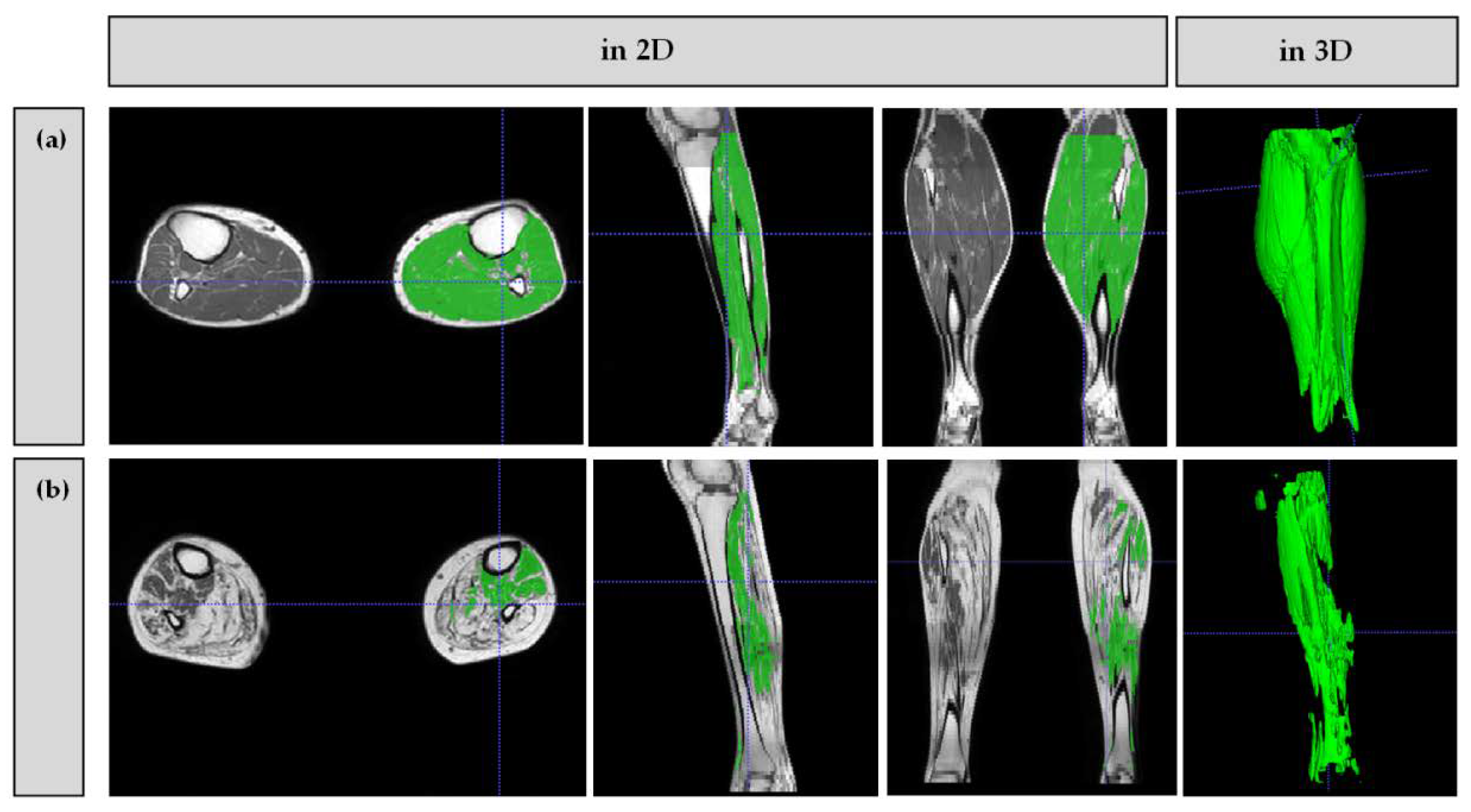 Brainsci 11 00202 g003