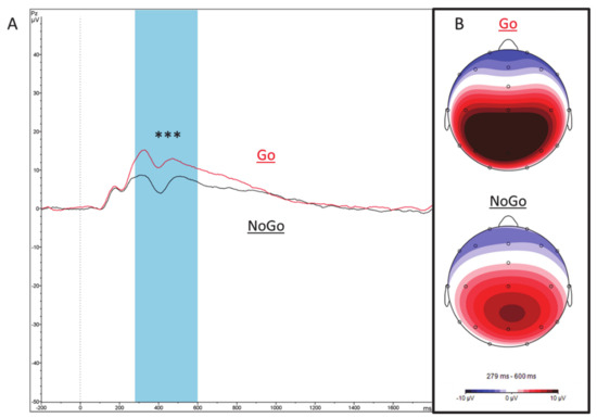 The sleep EEG envelope is a novel, neuronal firing-based
