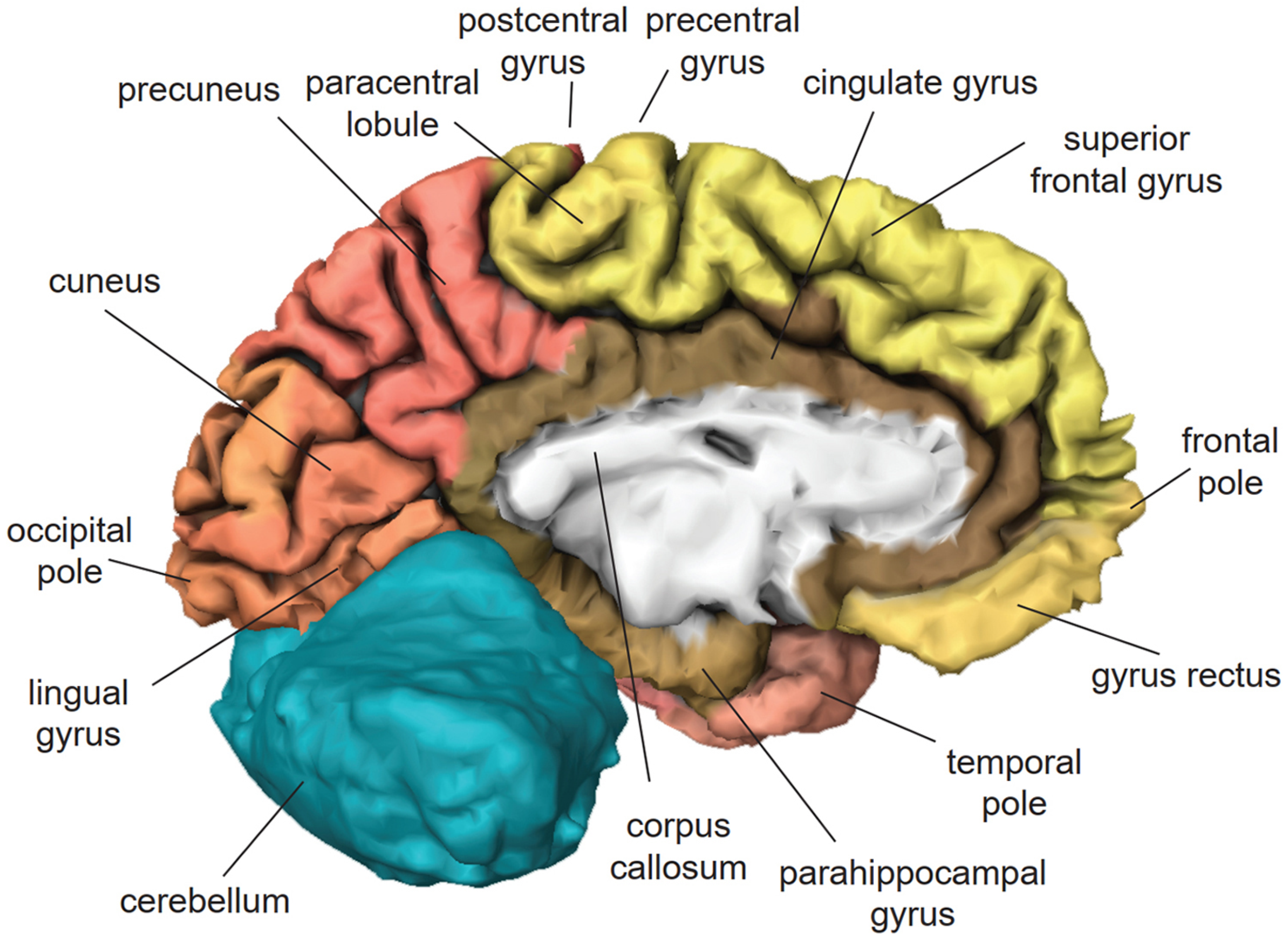 Brainsci 11 00221 g003 Brainsci 11 00221 g003