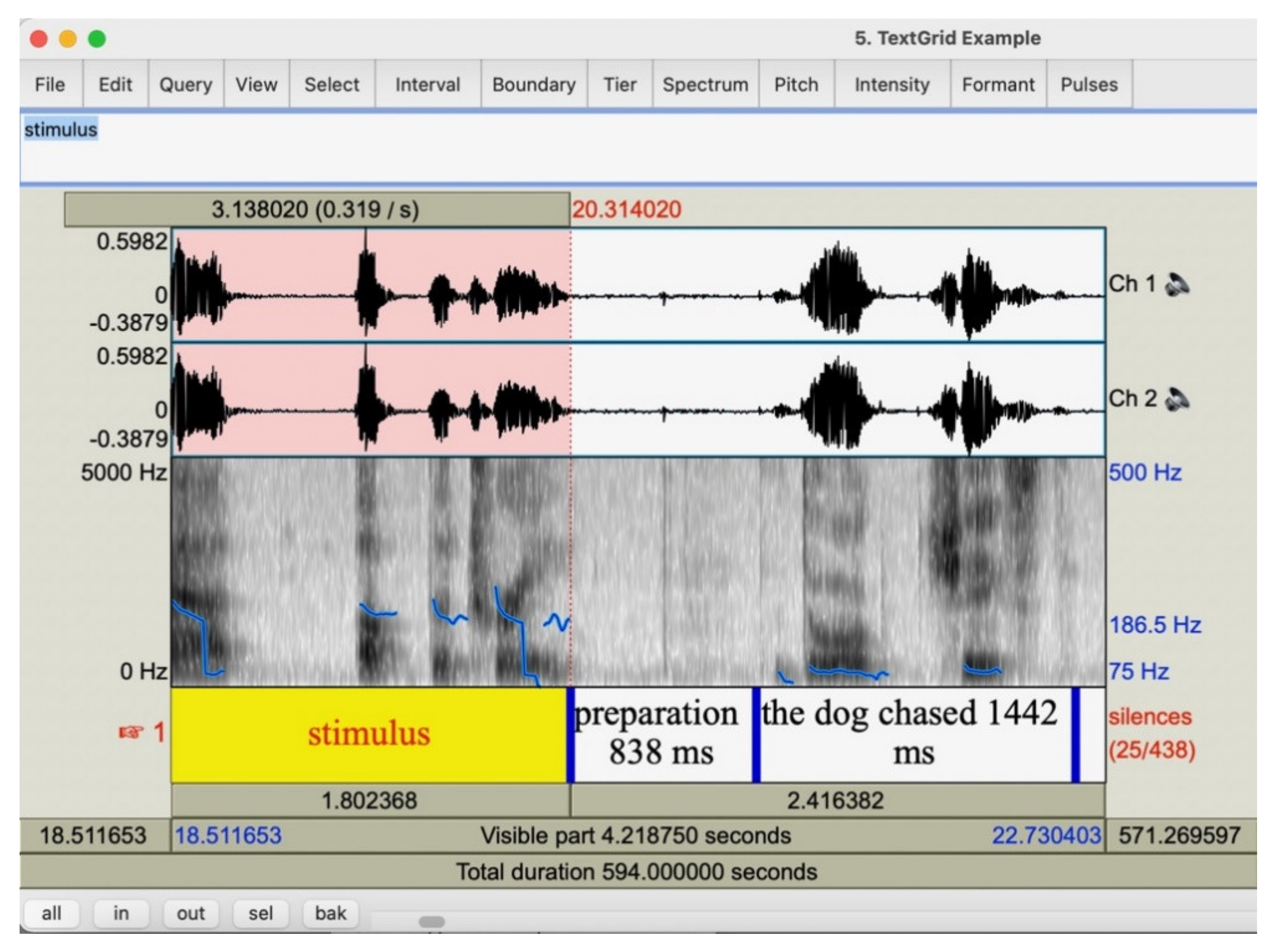 Brainsci 11 00230 g0a2