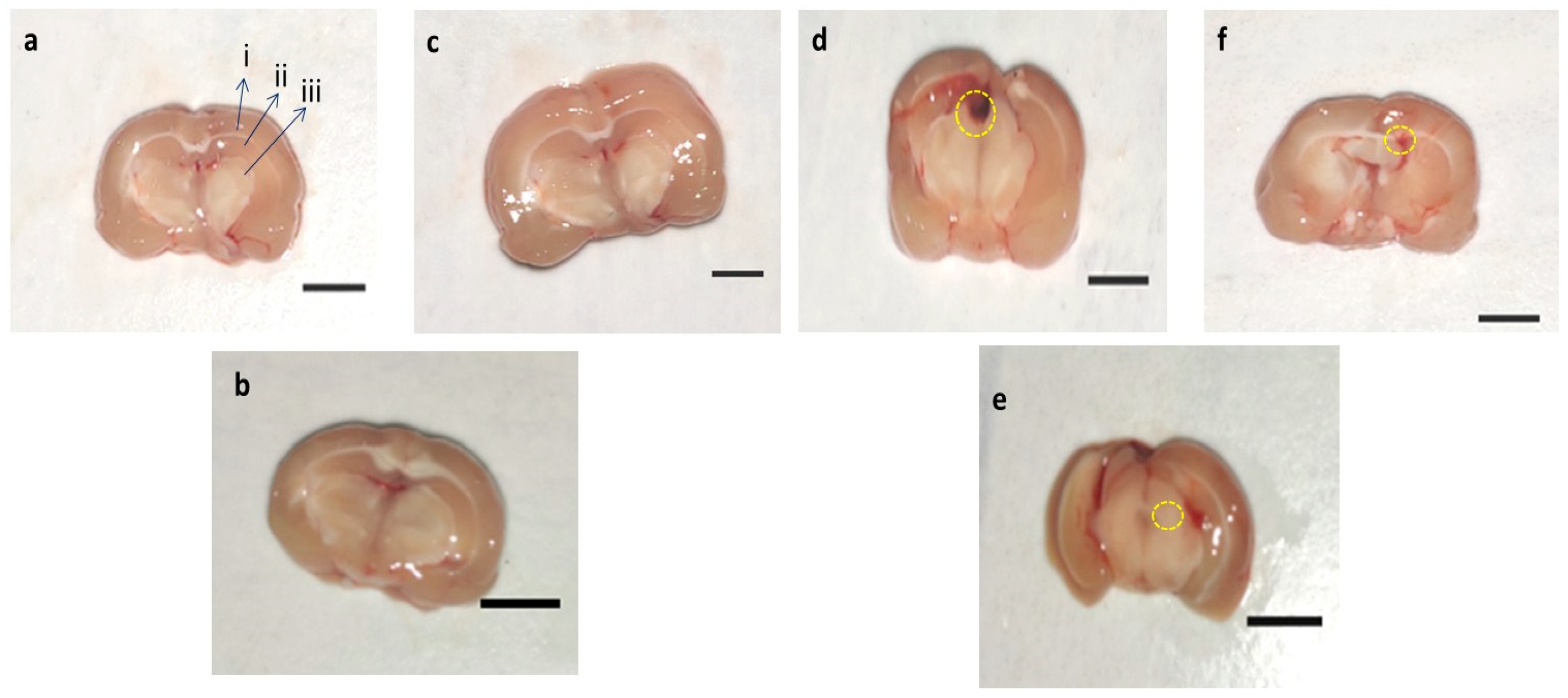Brainsci 11 00288 g009 Brainsci 11 00288 g009
