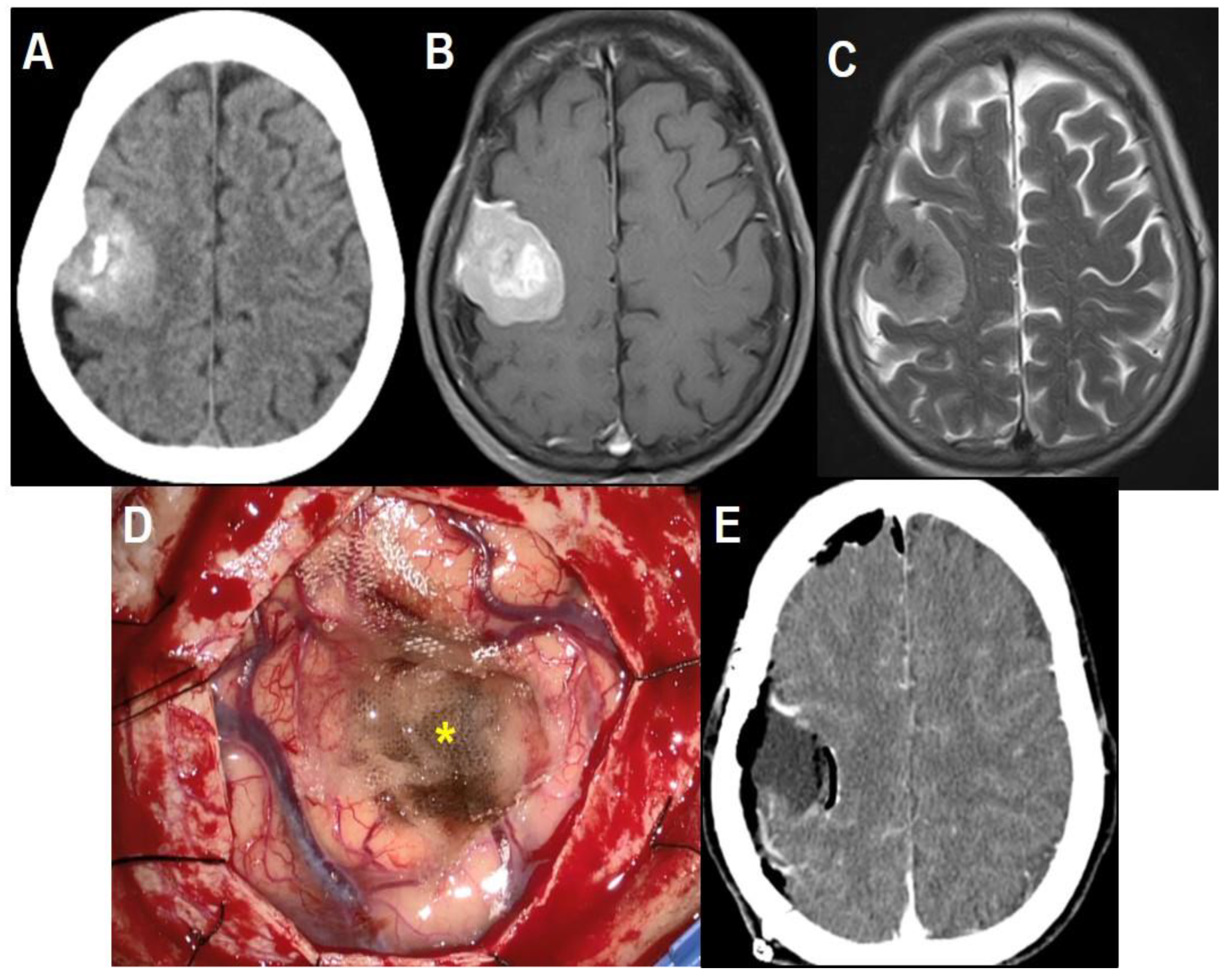 Brainsci 11 00299 g001