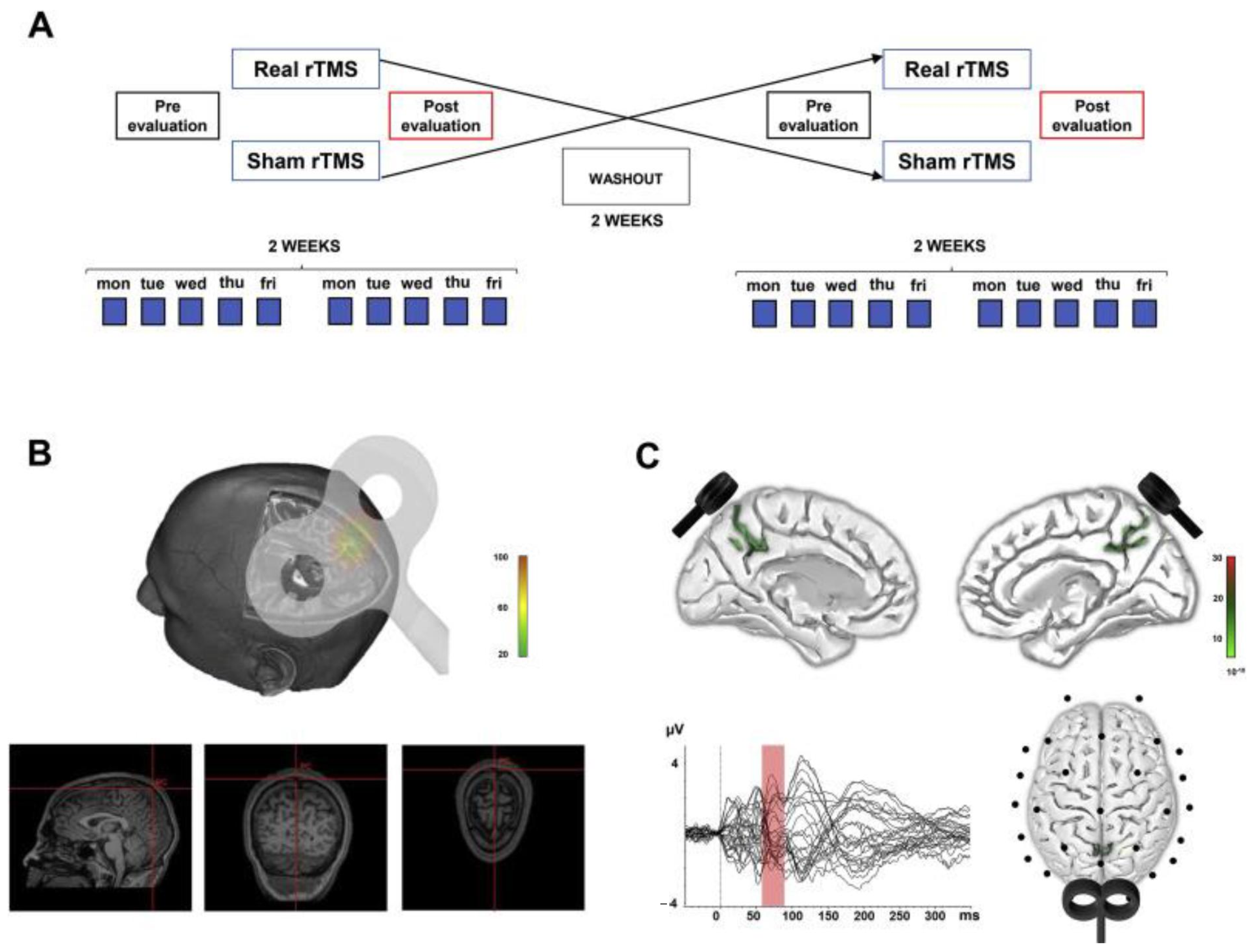 Brainsci 11 00303 g005 Brainsci 11 00303 g005