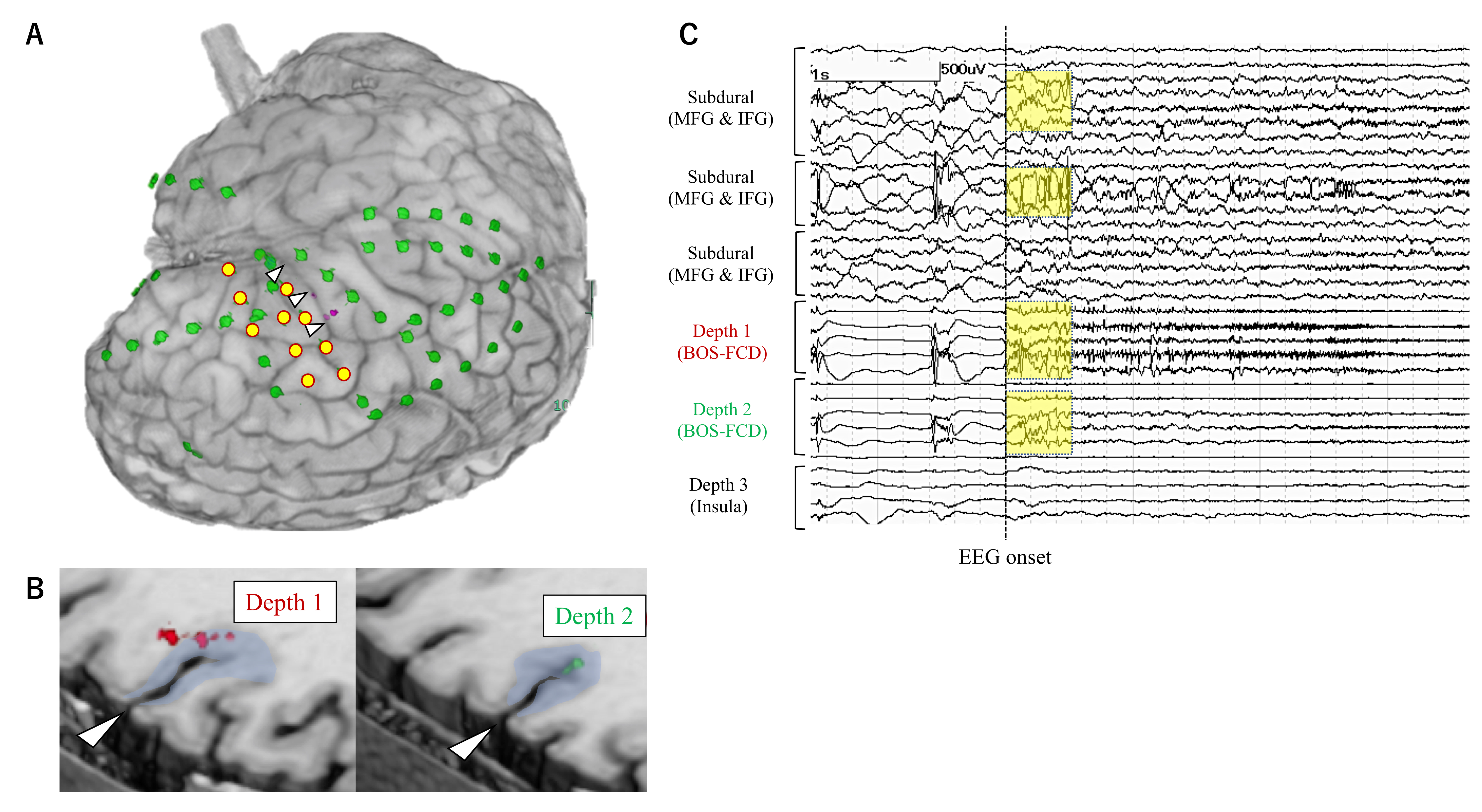Brainsci 11 00307 g001 Brainsci 11 00307 g001