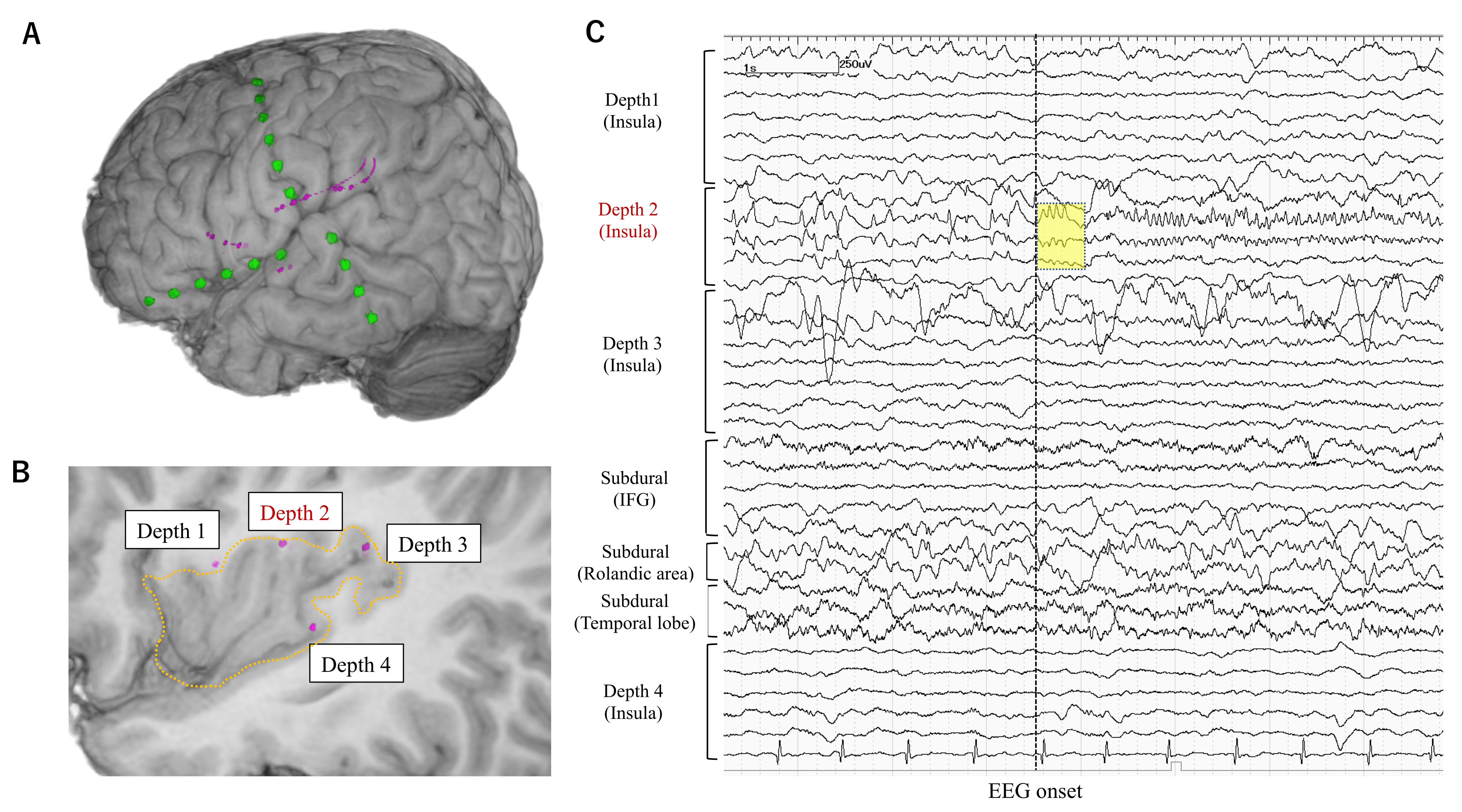 Brainsci 11 00307 g002 Brainsci 11 00307 g002