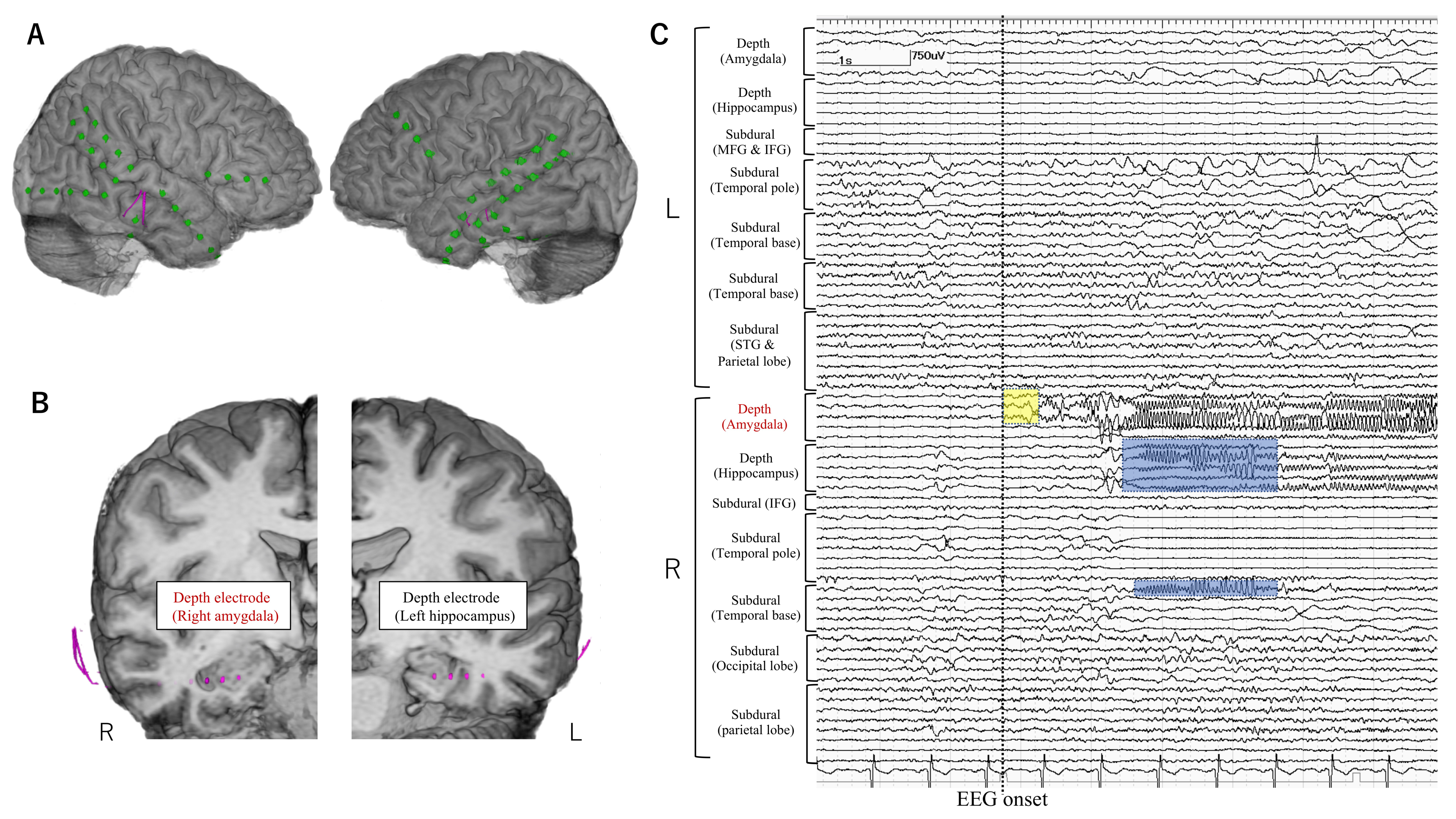 Brainsci 11 00307 g003 Brainsci 11 00307 g003
