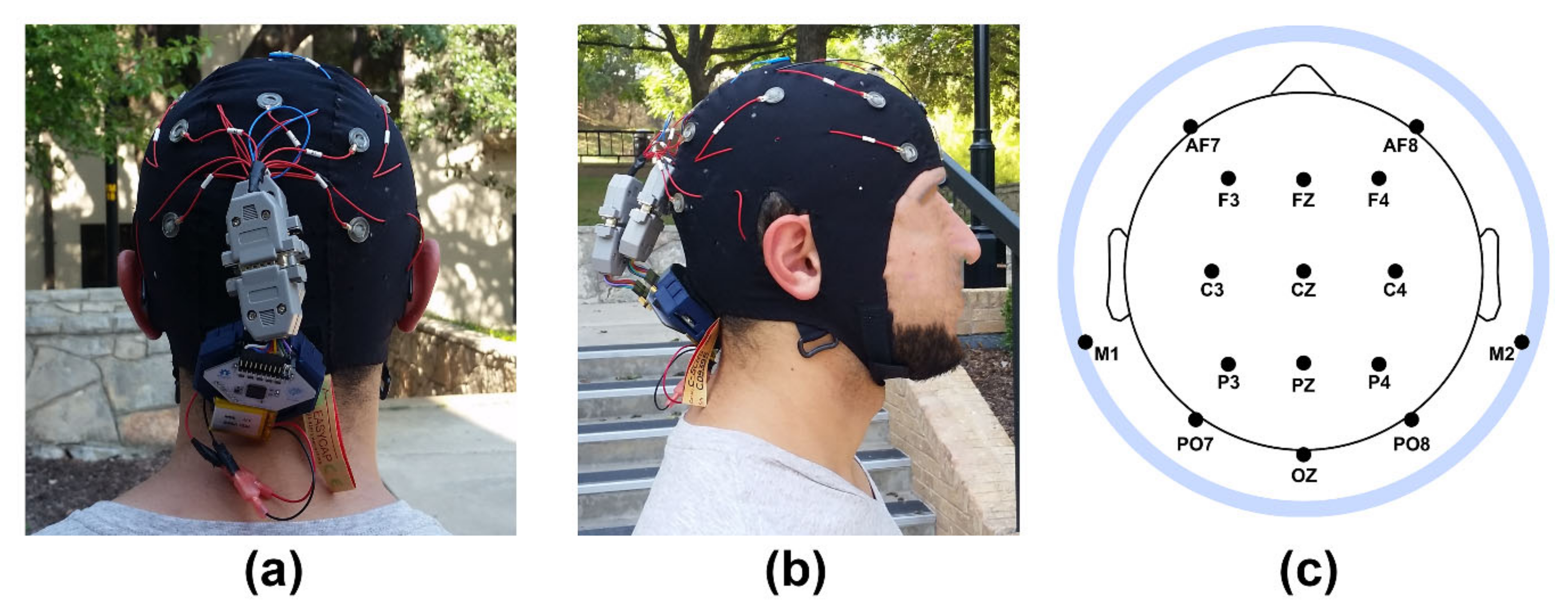 Temporo-insular enhancement of EEG low and high frequencies
