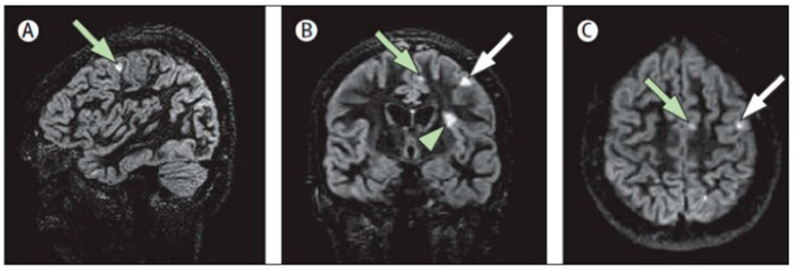 Brainsci 11 00346 g002 Brainsci 11 00346 g002