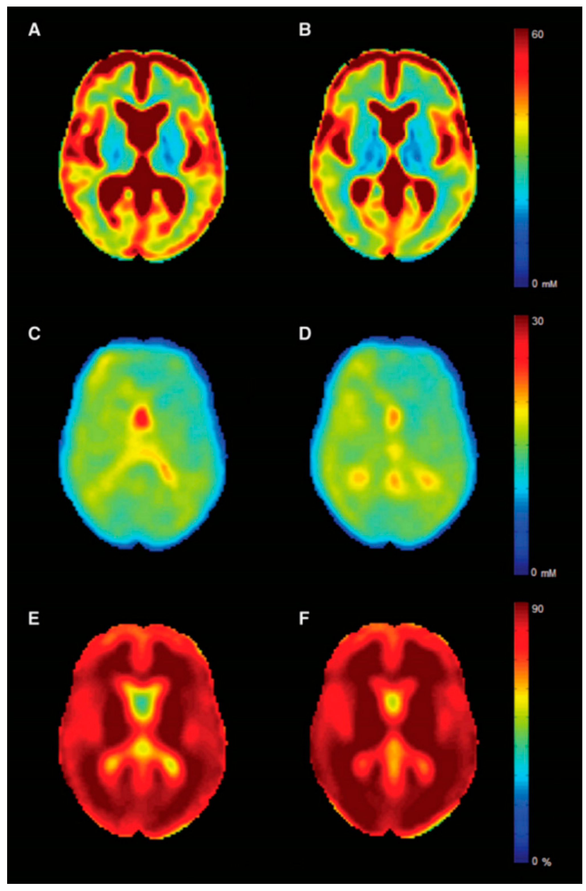 Brainsci 11 00346 g006 Brainsci 11 00346 g006