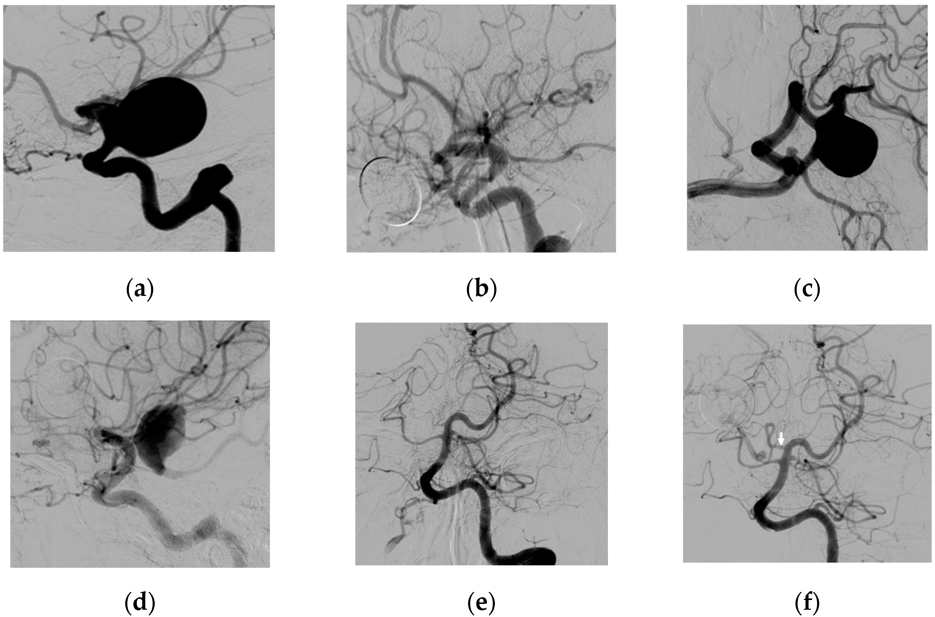 Brainsci 11 00349 g001 Brainsci 11 00349 g001