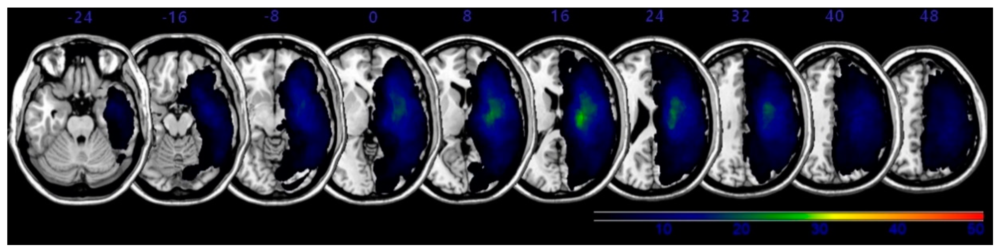 Brainsci 11 00354 g001