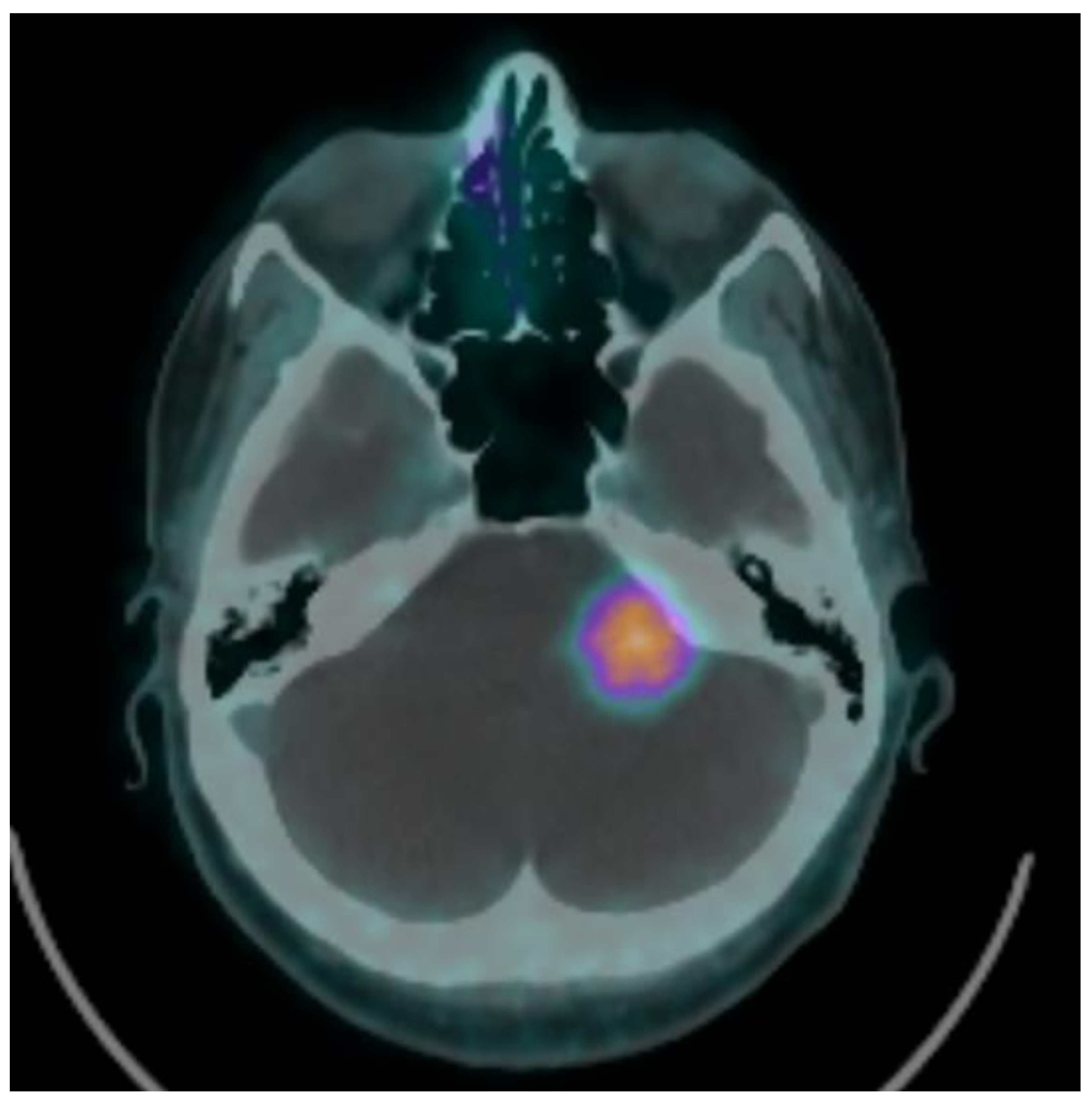 Brainsci 11 00375 g001