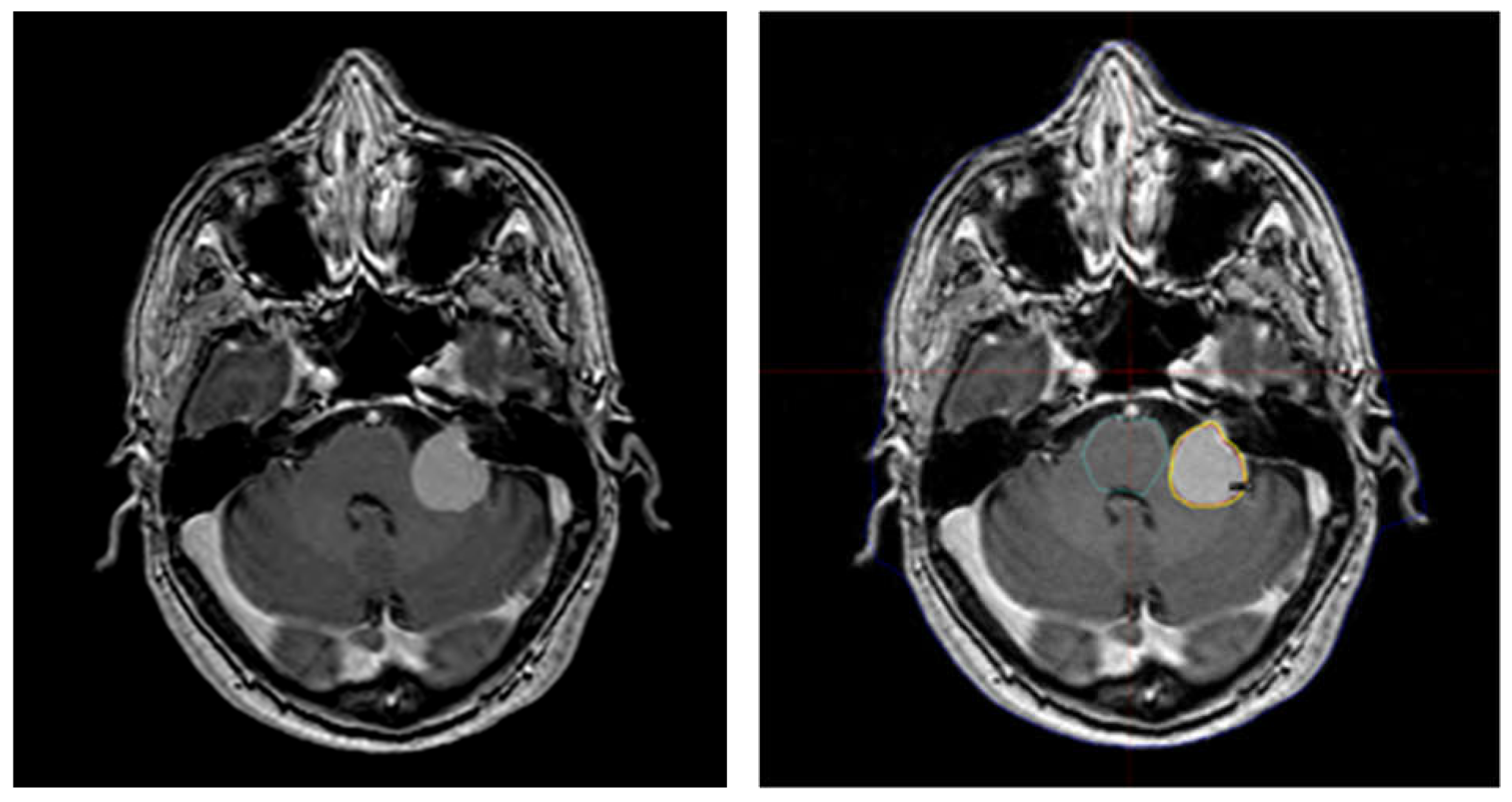 Brainsci 11 00375 g002