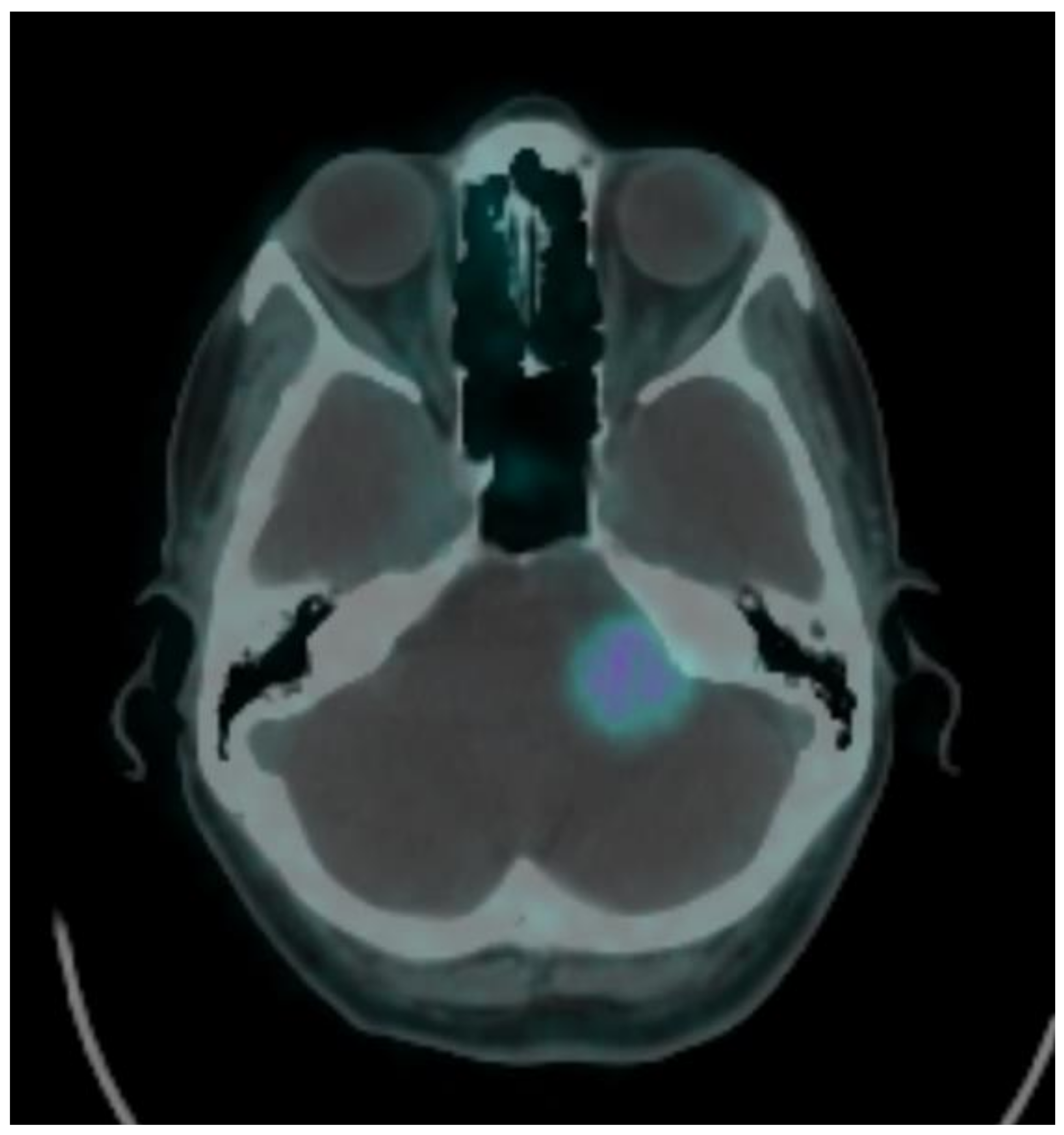 Brainsci 11 00375 g003