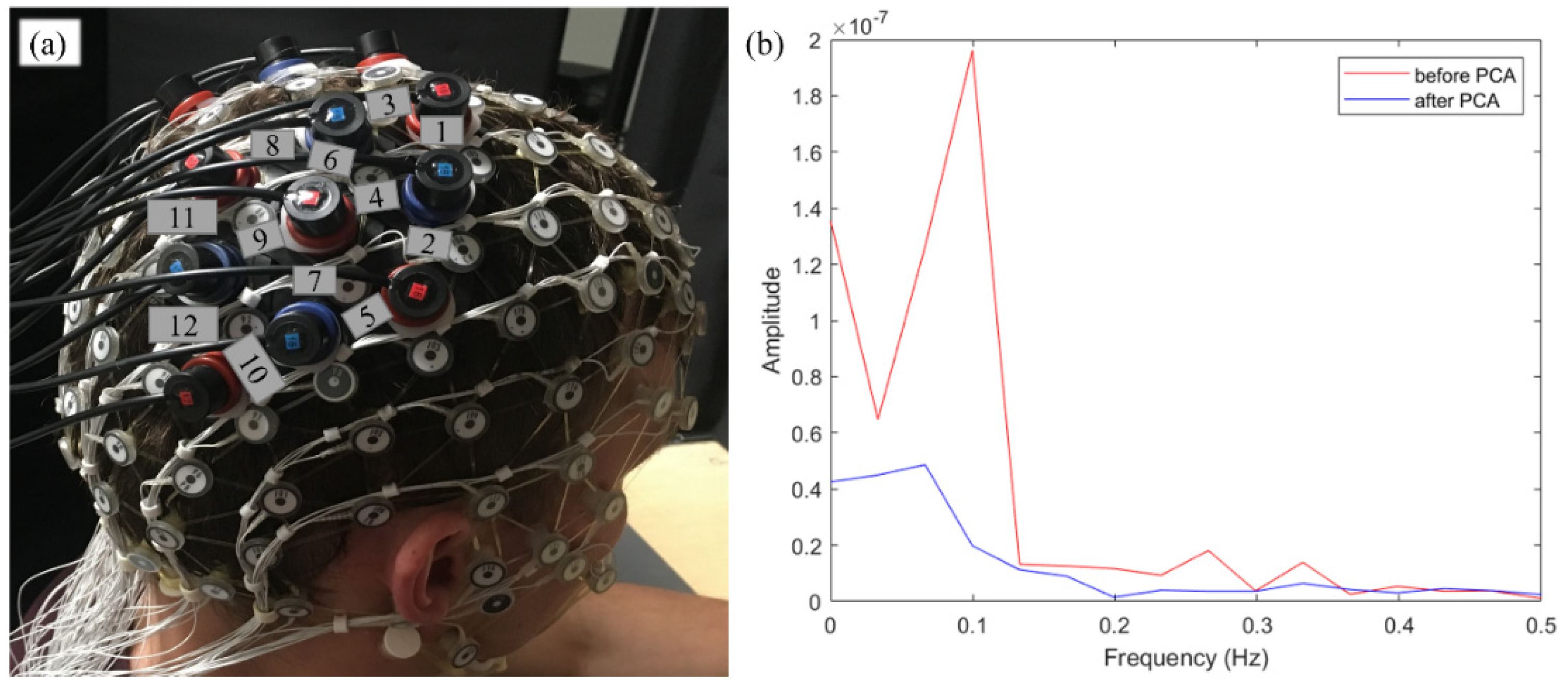 Brainsci 11 00397 g001 Brainsci 11 00397 g001