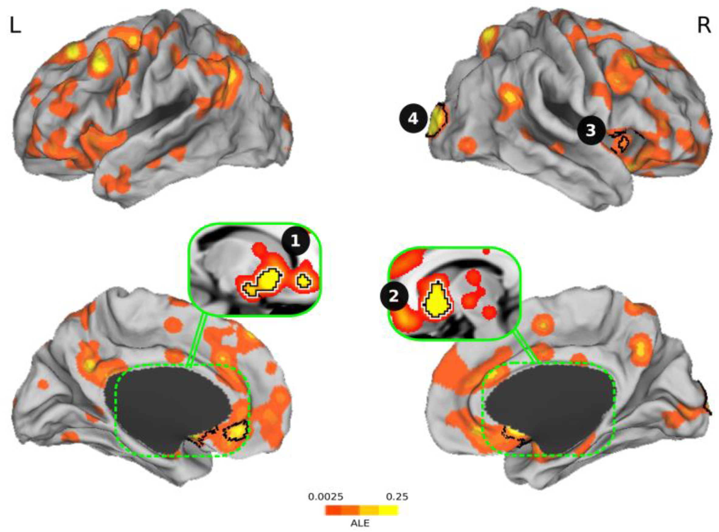 Brainsci 11 00399 g002