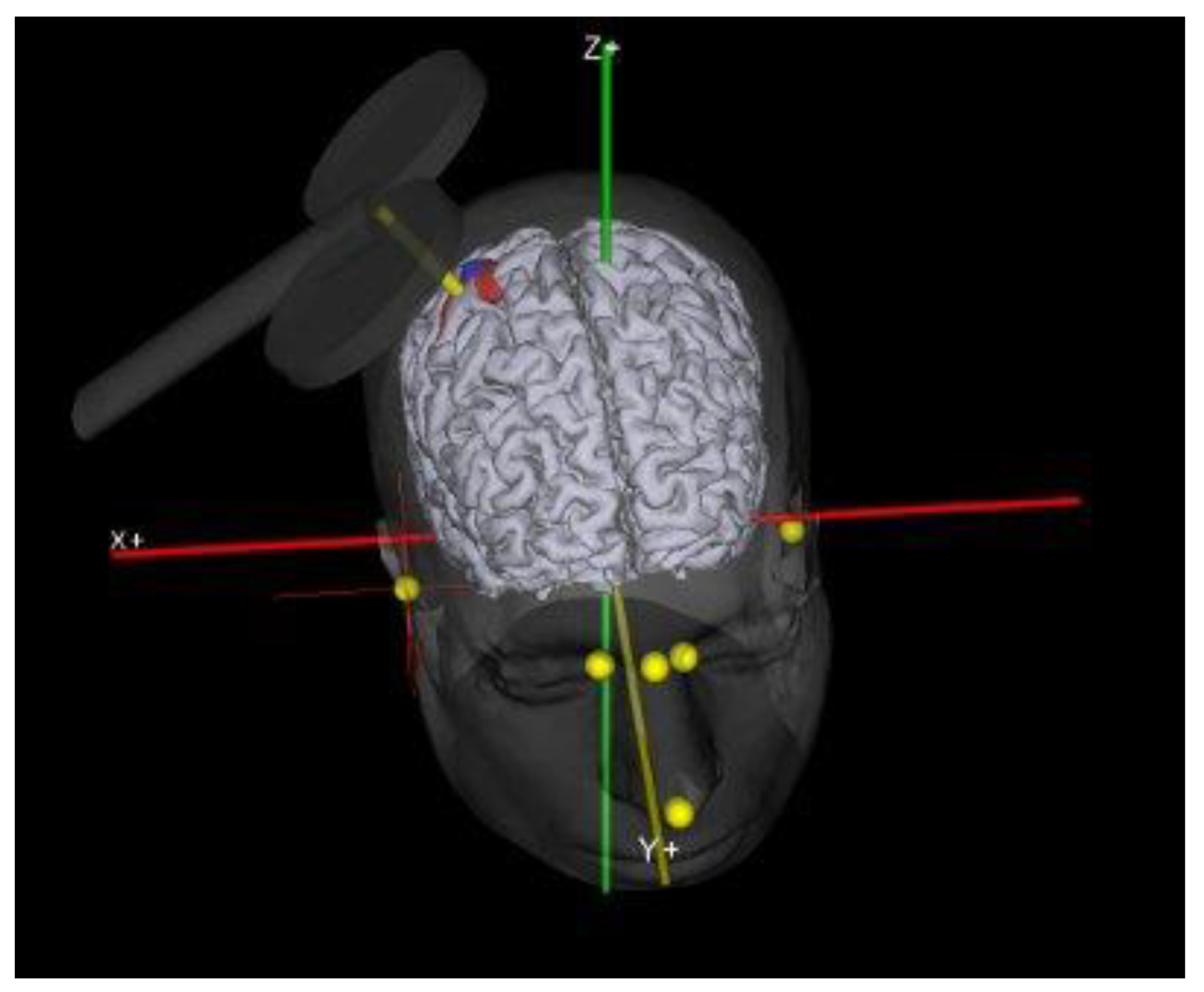 Brainsci 11 00432 g003